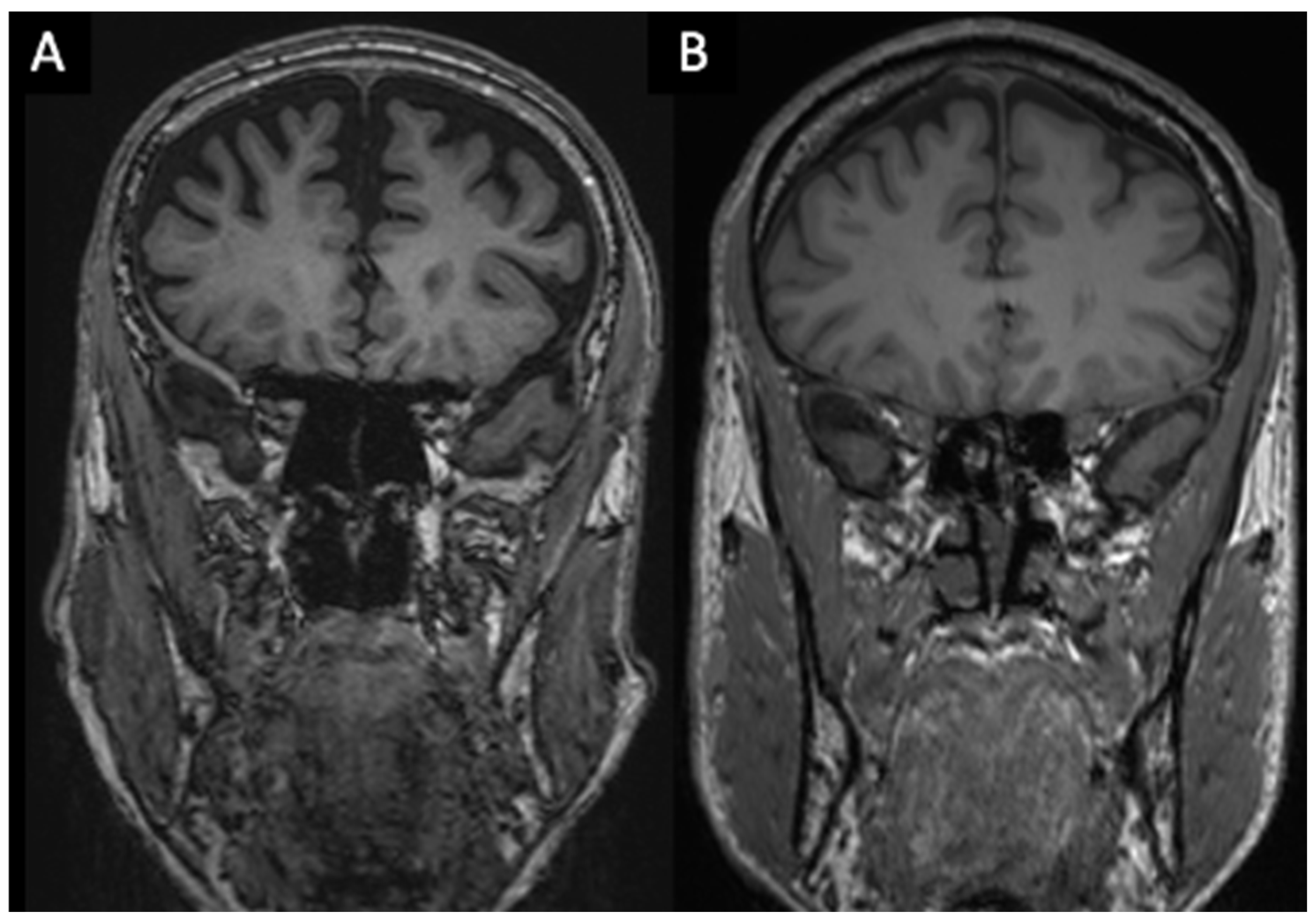 Brainsci 16 00403 g005 Brainsci 16 00403 g005