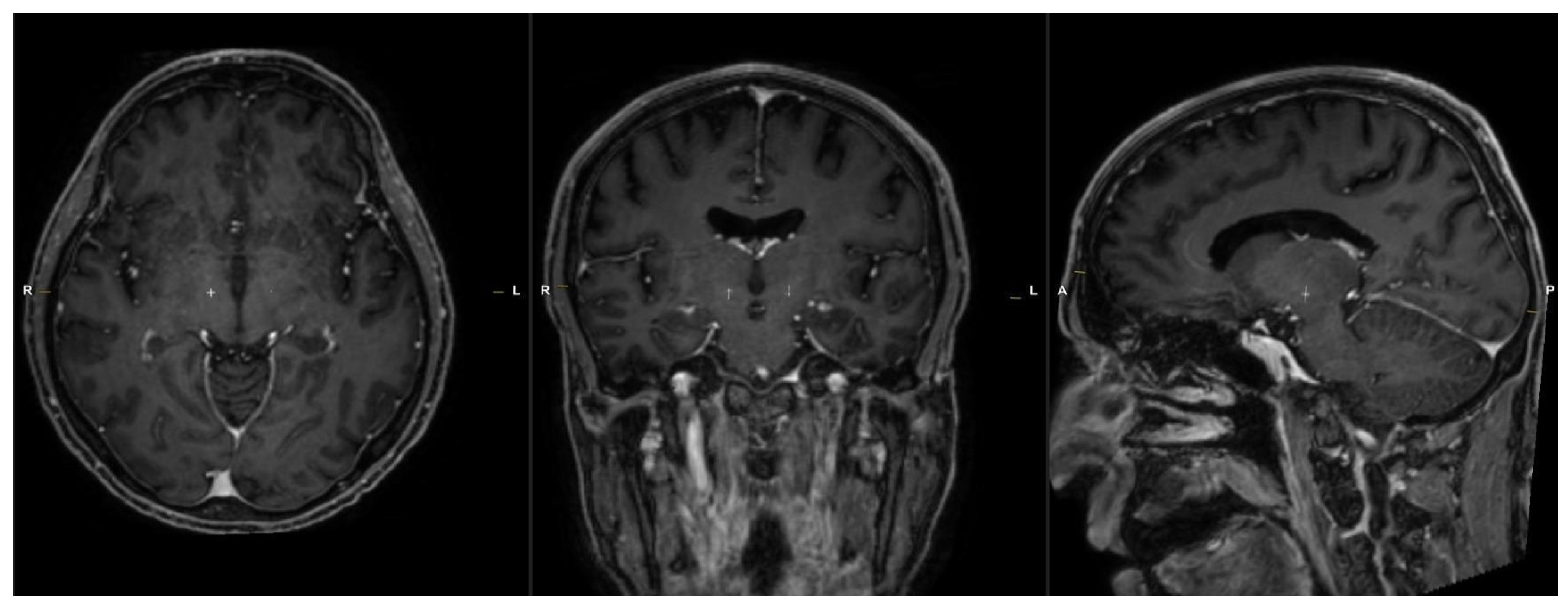 Brainsci 16 00457 g002