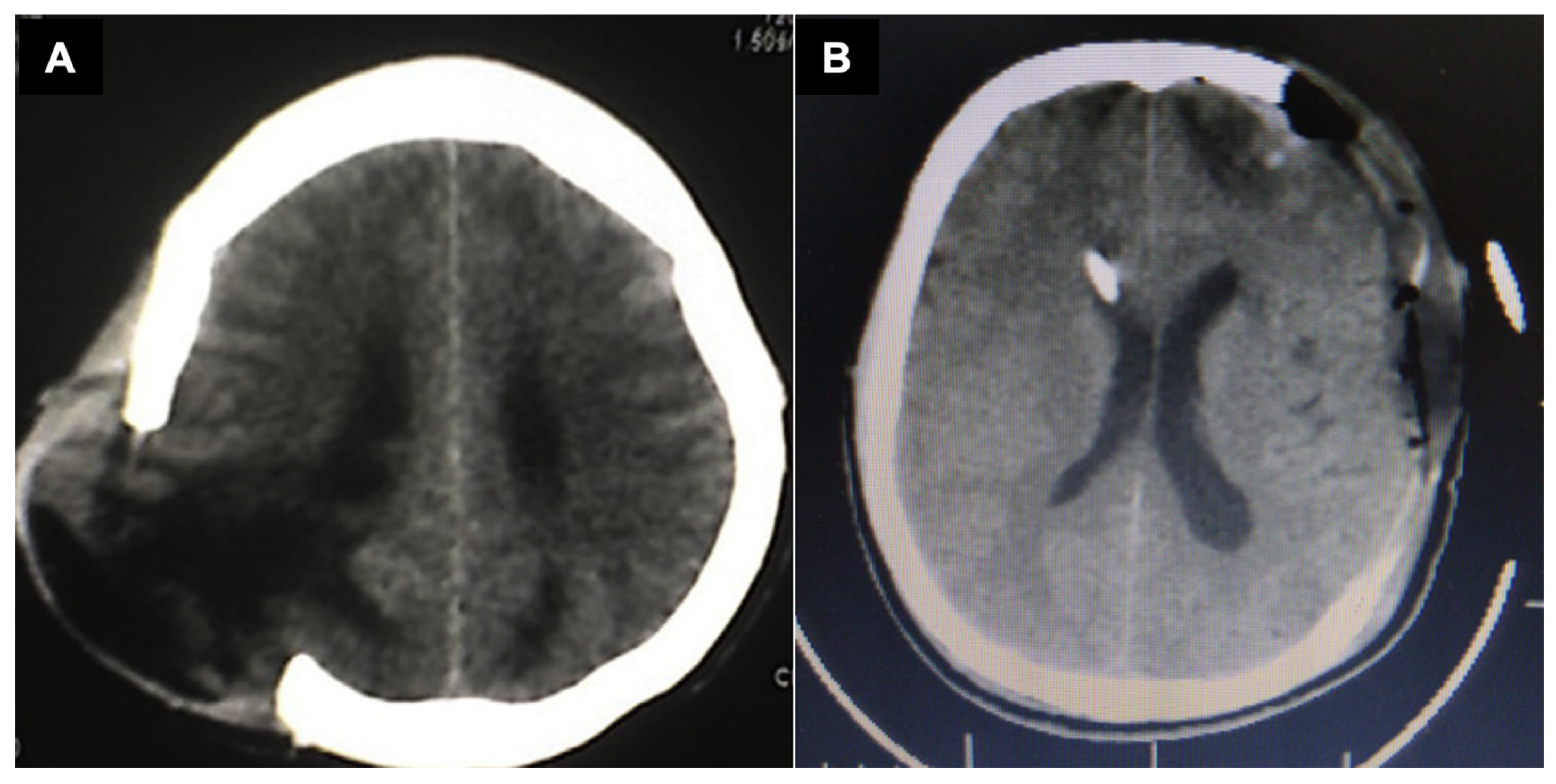 Brainsci 16 00538 g004 Brainsci 16 00538 g004