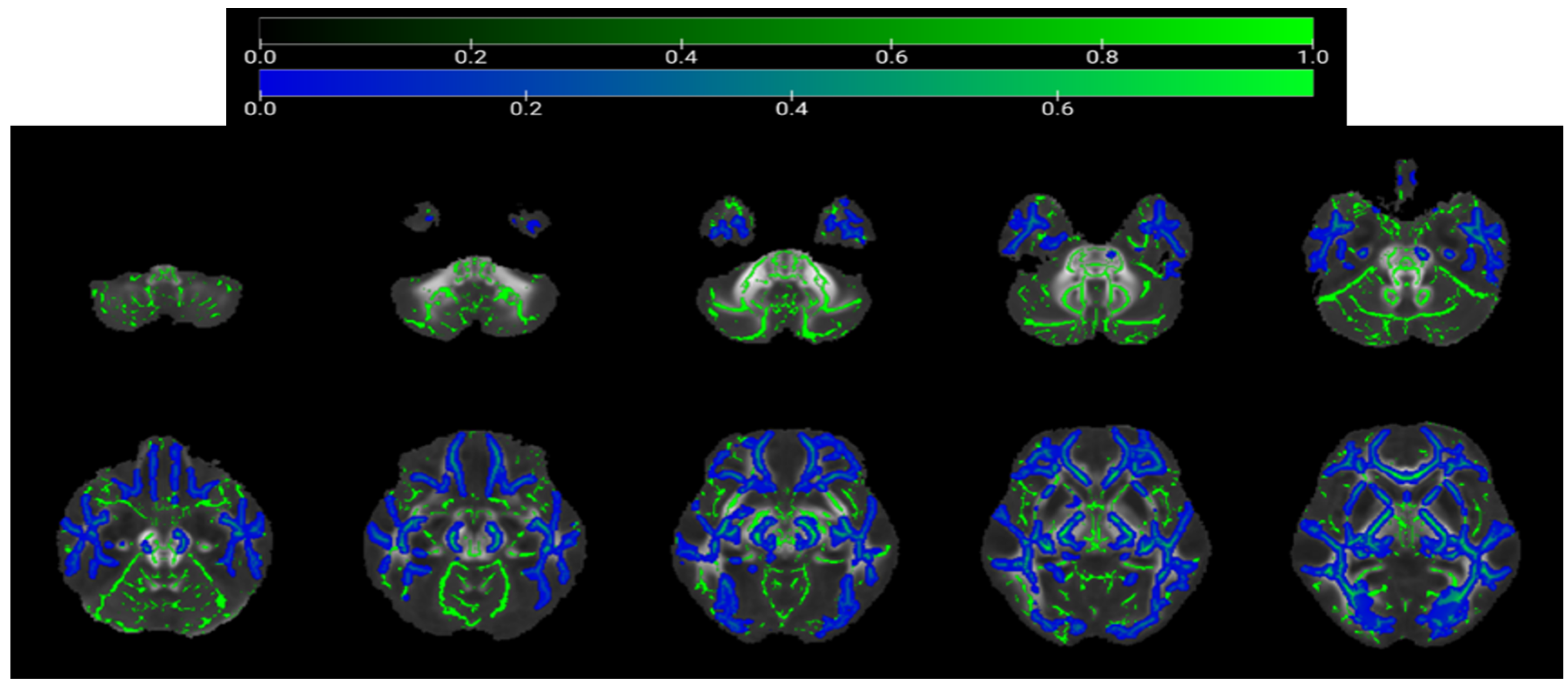 Brainsci 16 00655 g003 Brainsci 16 00655 g003