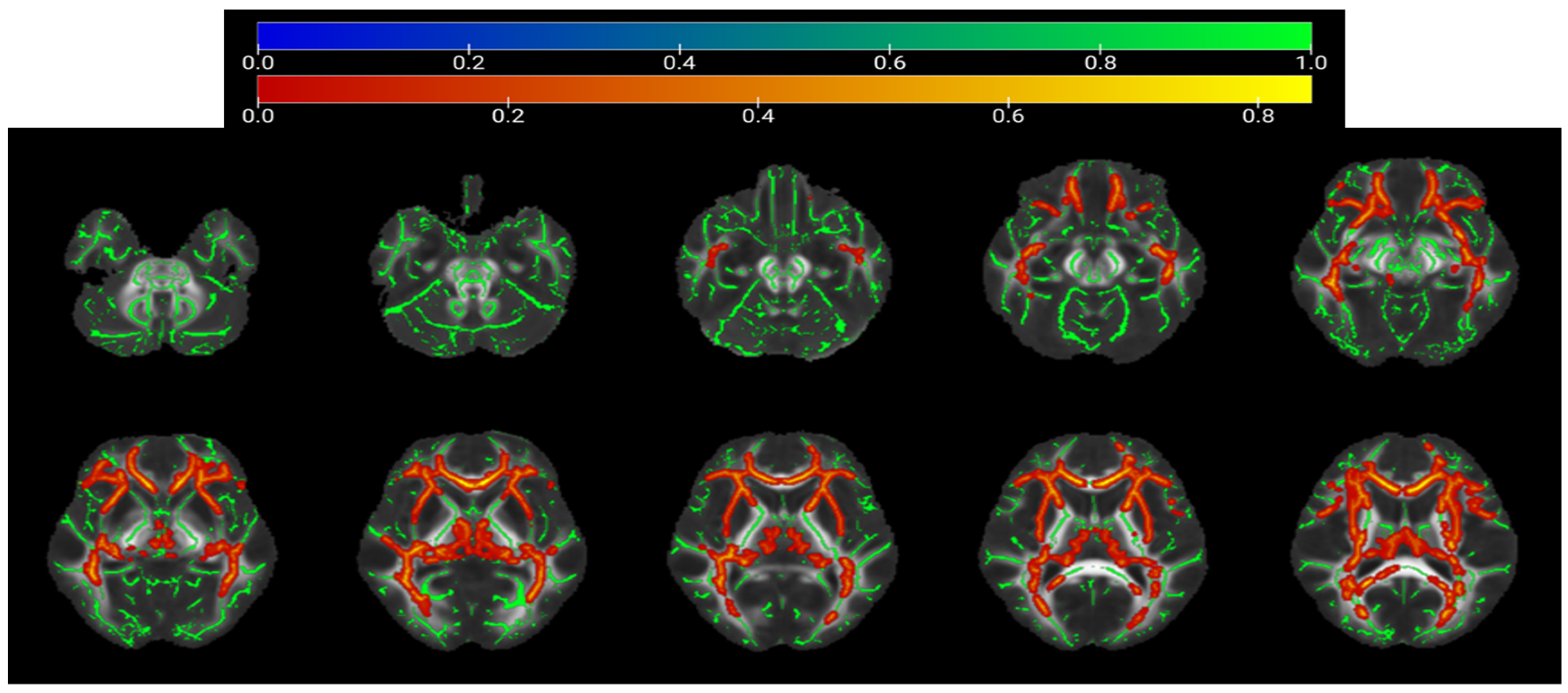 Brainsci 16 00655 g004 Brainsci 16 00655 g004