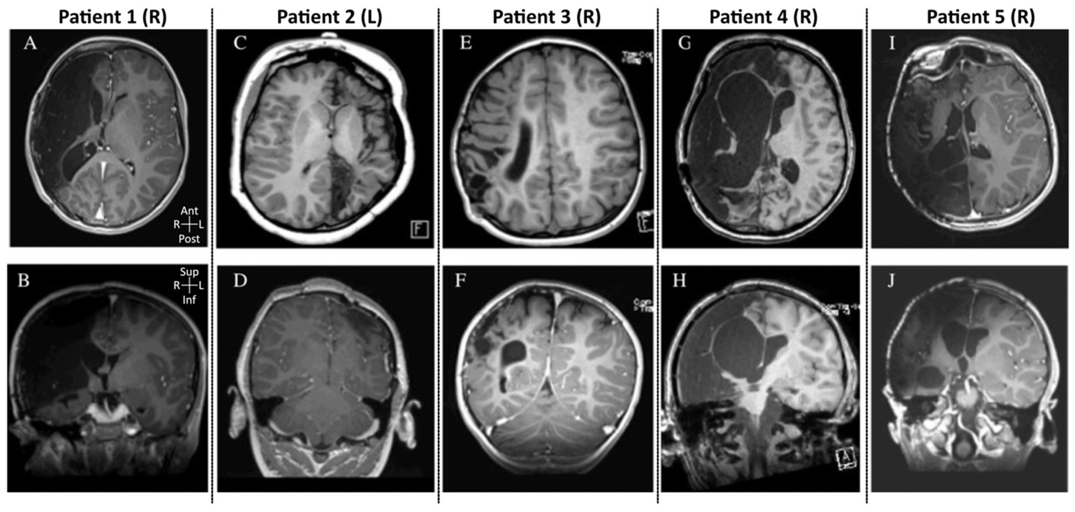 Brainsci 16 00657 g001 Brainsci 16 00657 g001