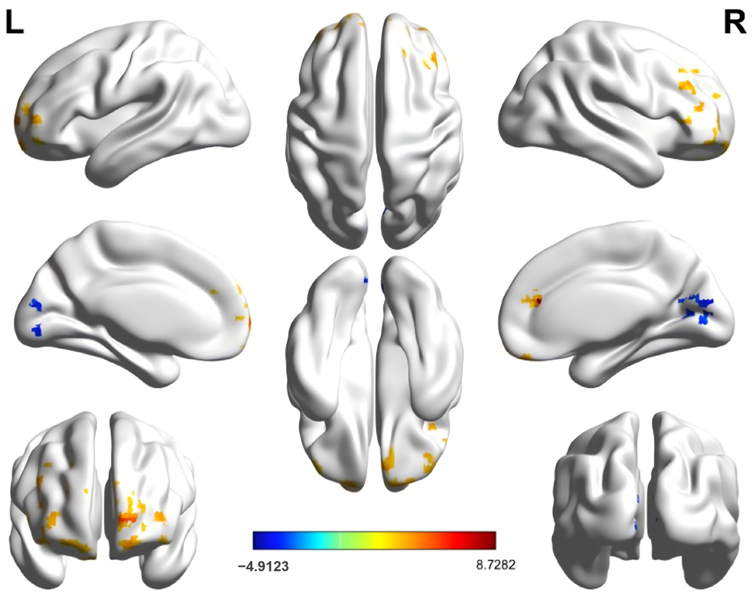 A Brain Imaging Study on the Association Between Chess Expertise