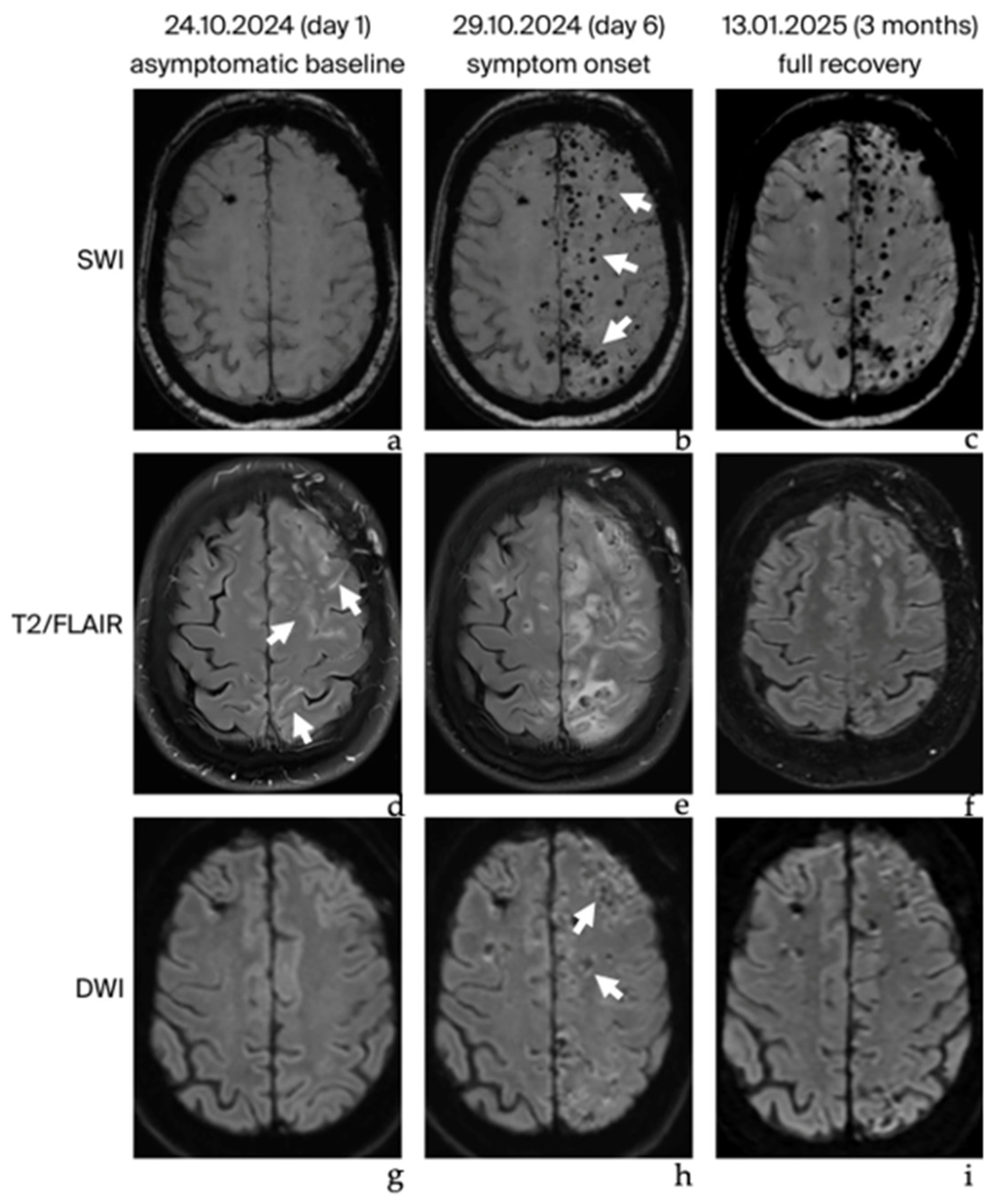 Brainsci 16 00785 g001 Brainsci 16 00785 g001
