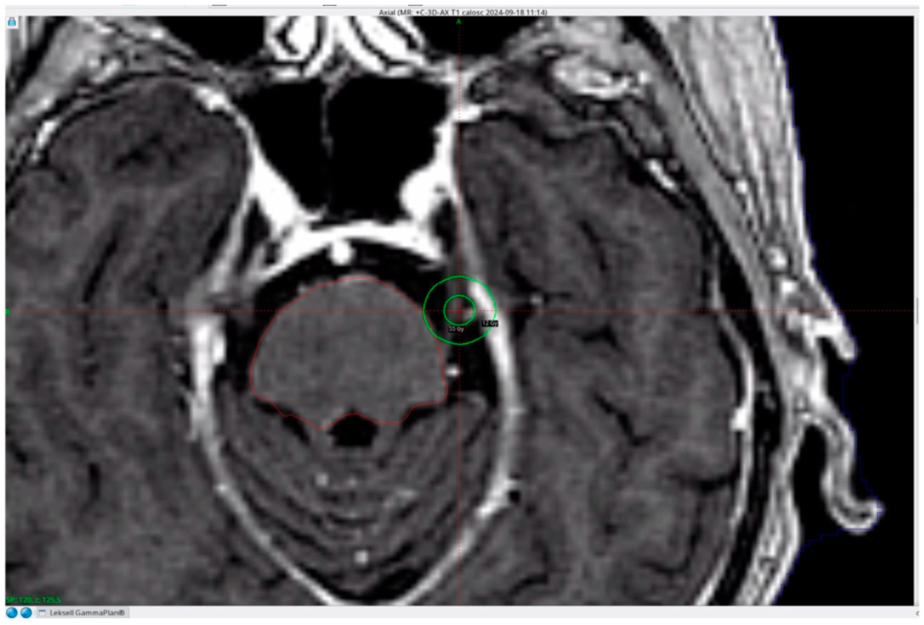 Brainsci 16 00997 g001 Brainsci 16 00997 g001