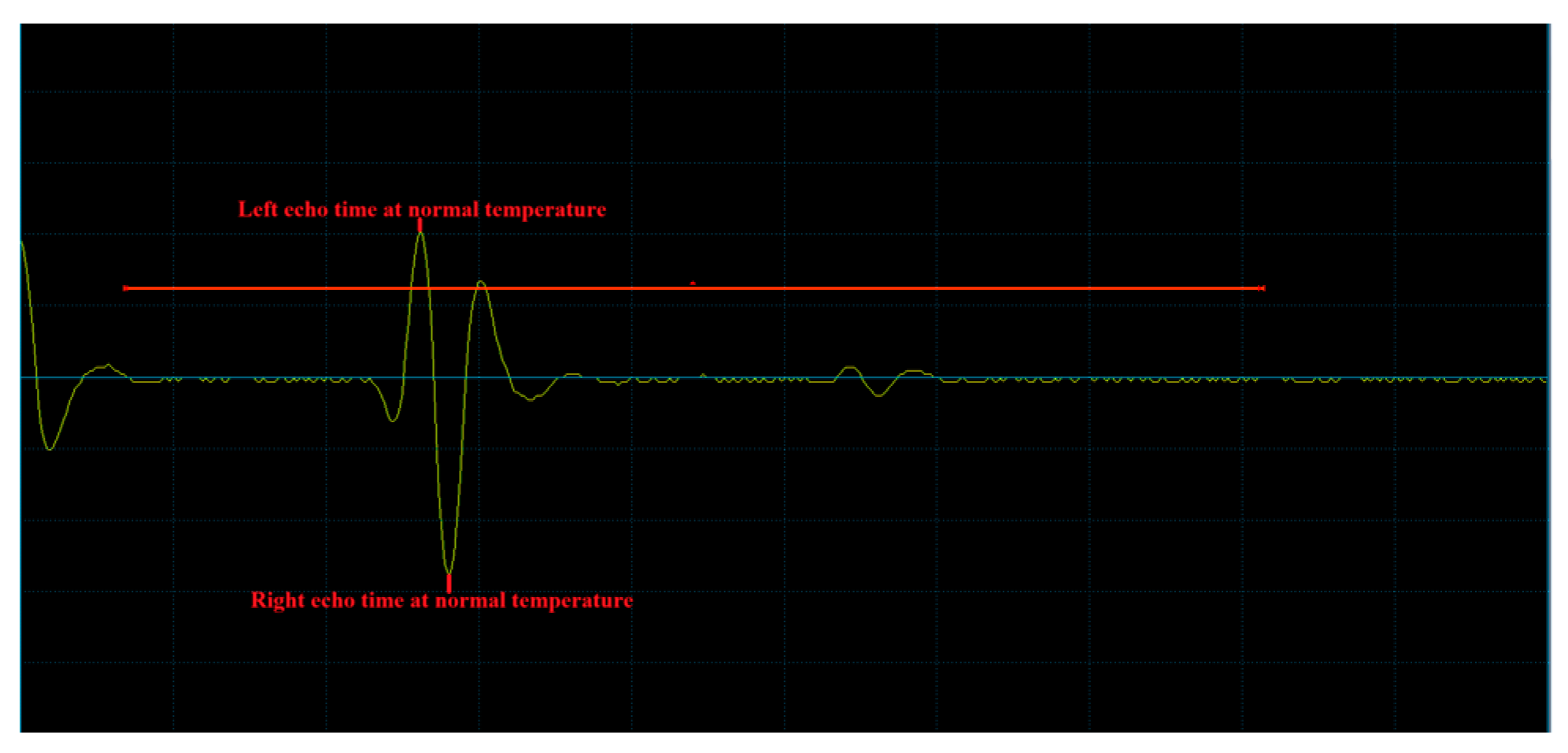 Buildings 15 00296 g018
