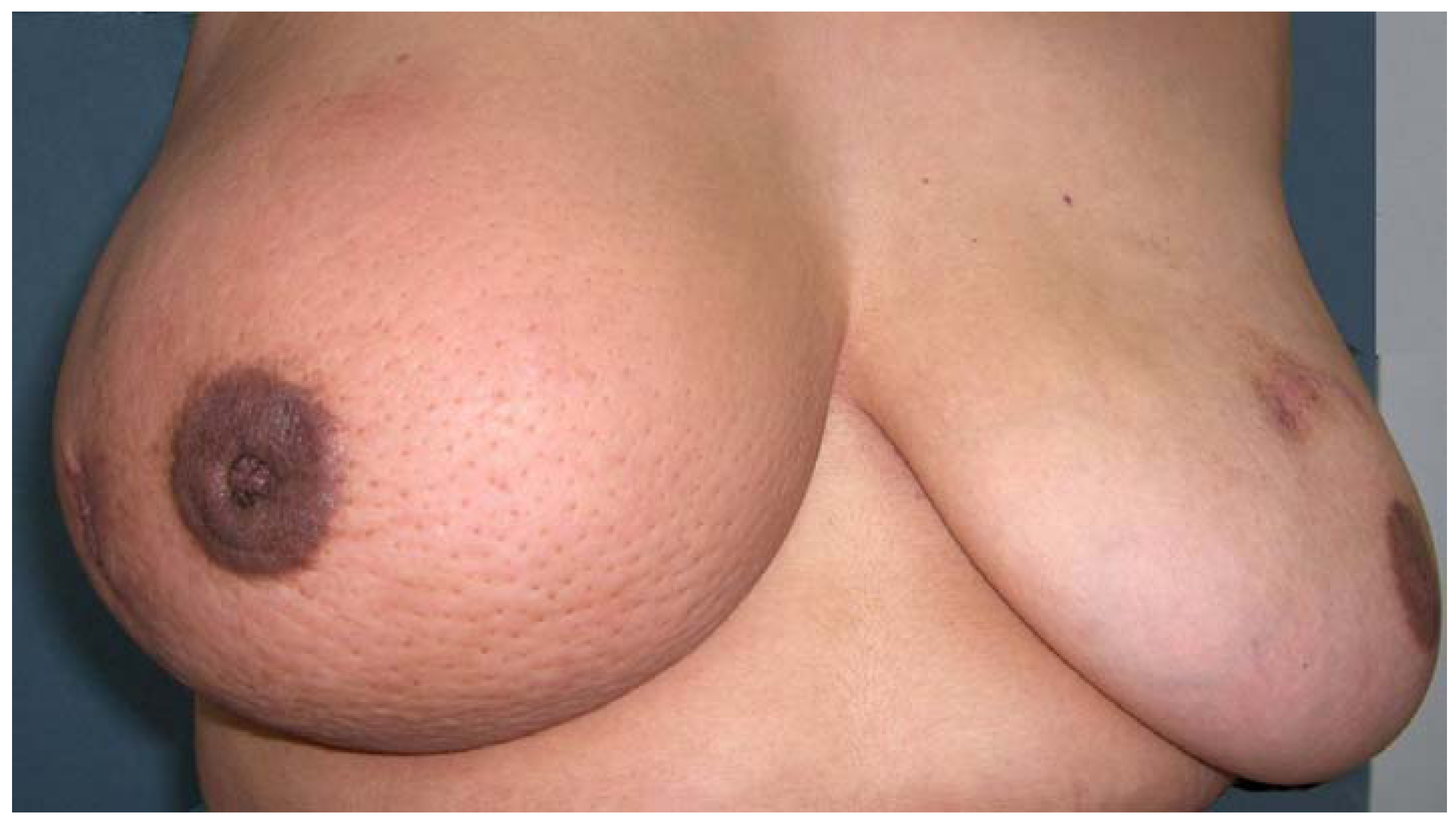 Cancers 02 00143 g001 1024