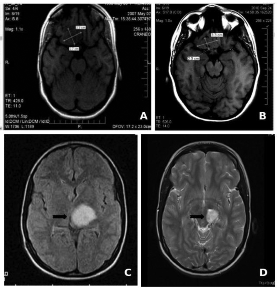 Cancers 03 02014f1 1024