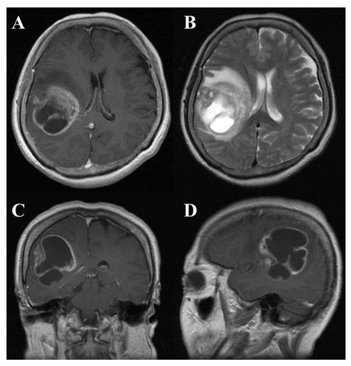 Cancers 03 03242f1 1024