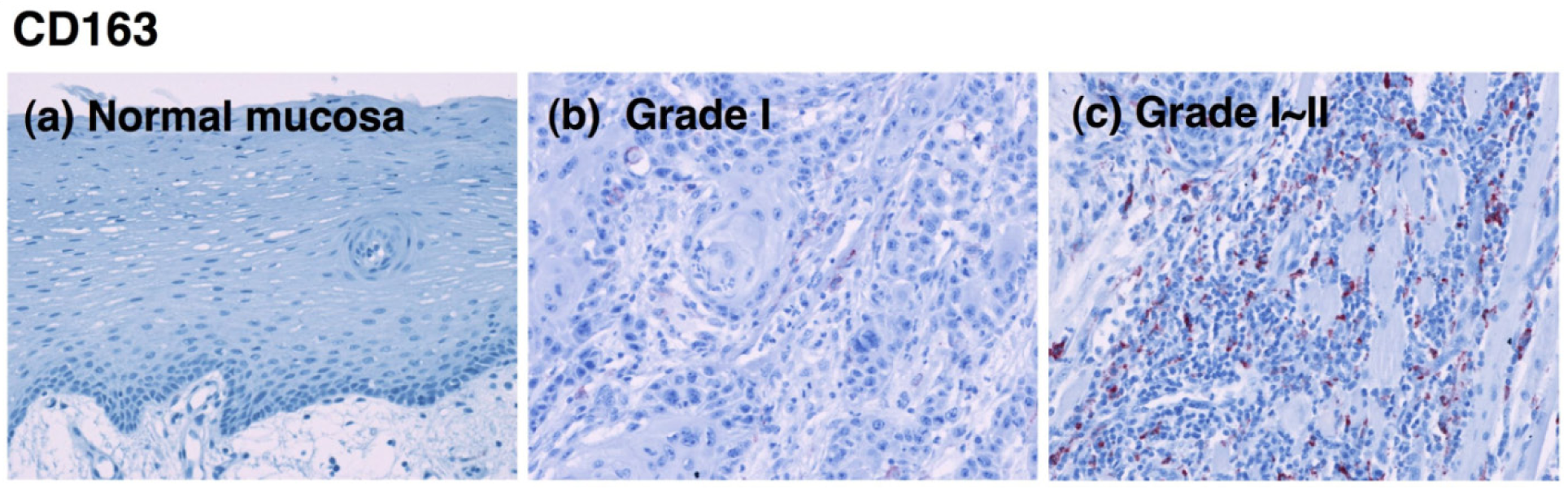 Cancers 03 03726f3a 1024