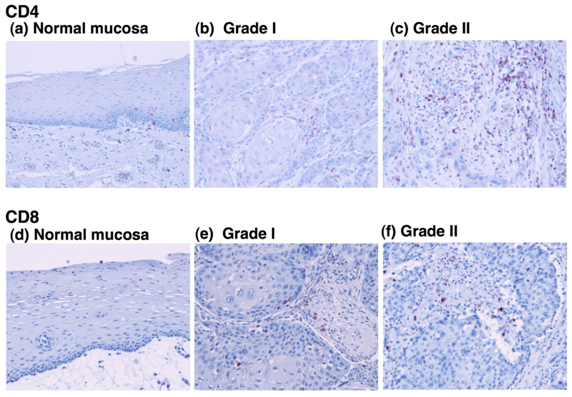Cancers 03 03726f4 1024