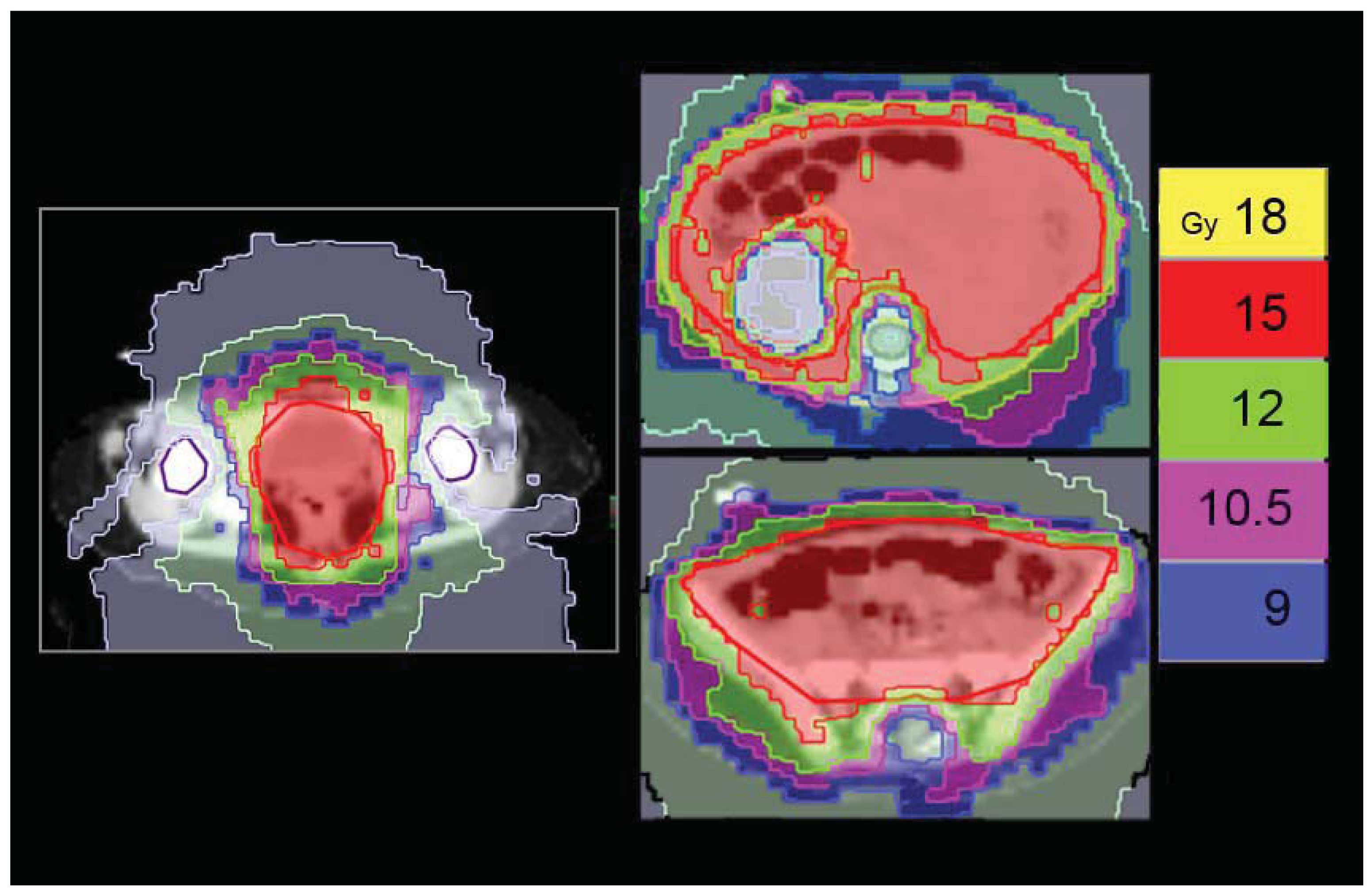 Cancers 03 03972f10 1024