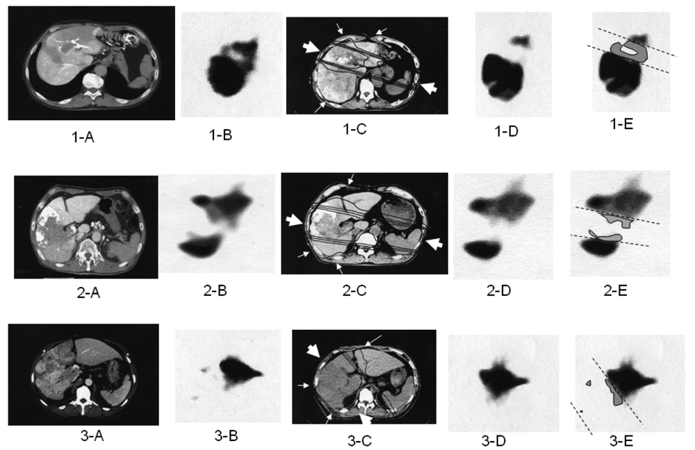 Cancers 03 04114f2 1024