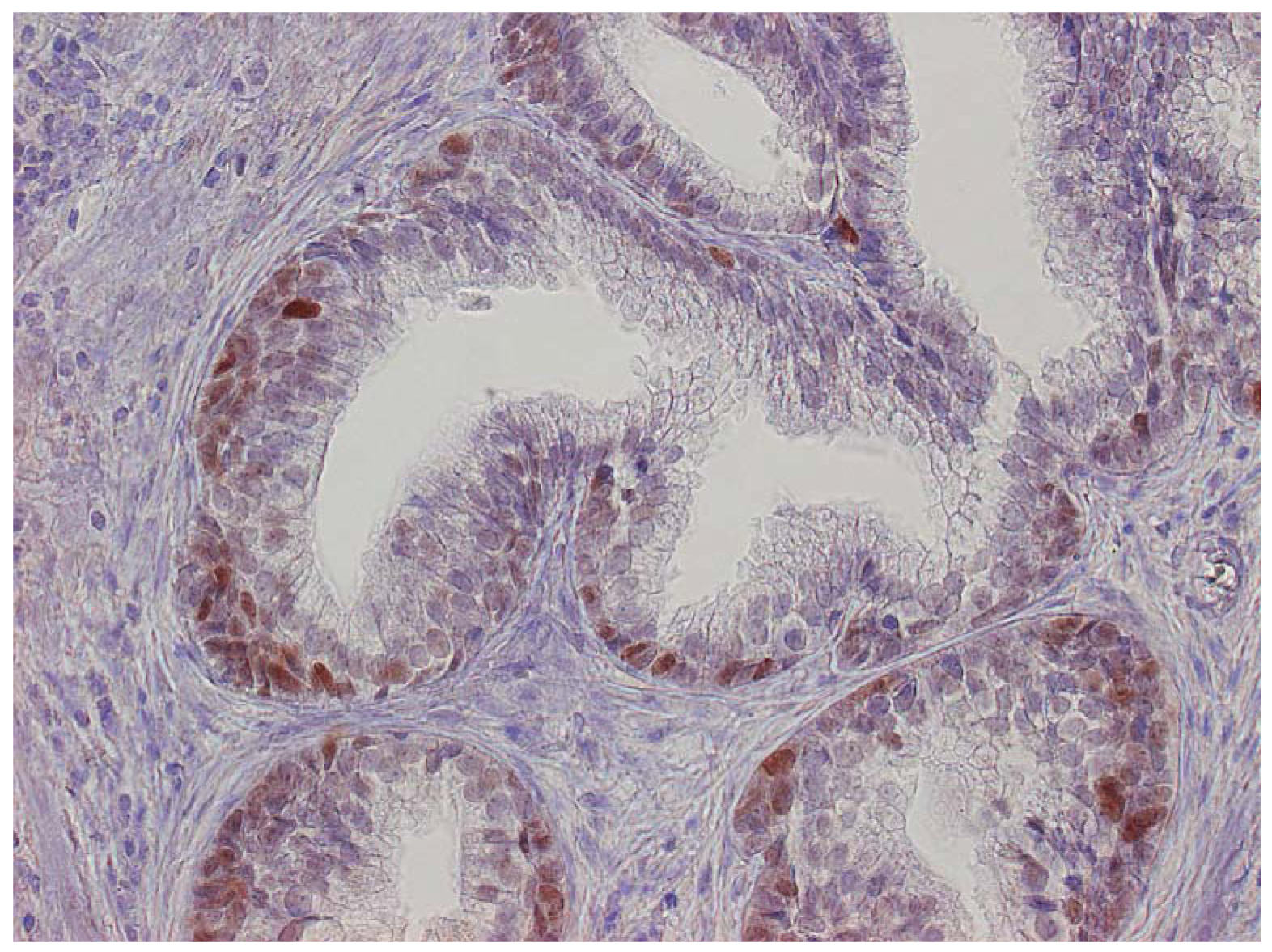 Cancers 03 04127f3 1024