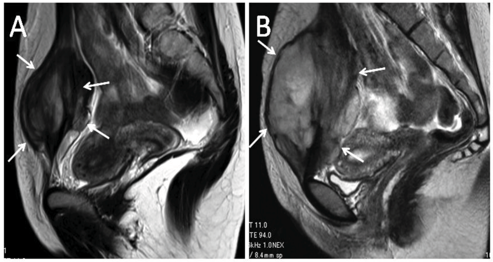 Cancers 04 00088 g002