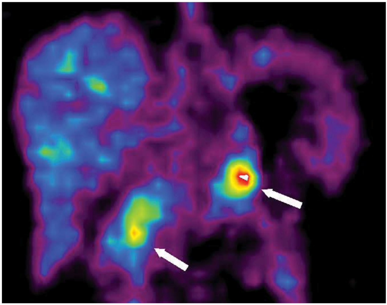 Cancers 04 00100 g003 1024