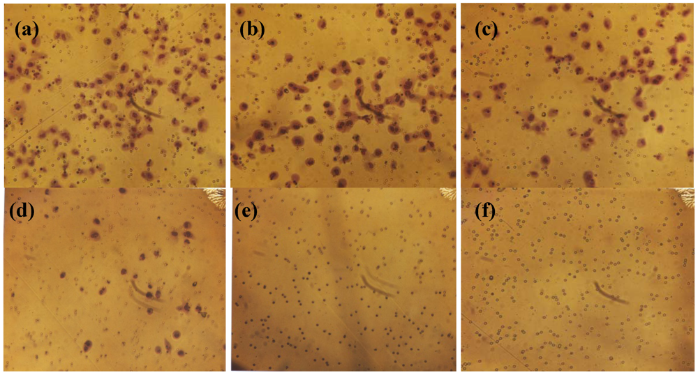 Cancers 04 00323 g005