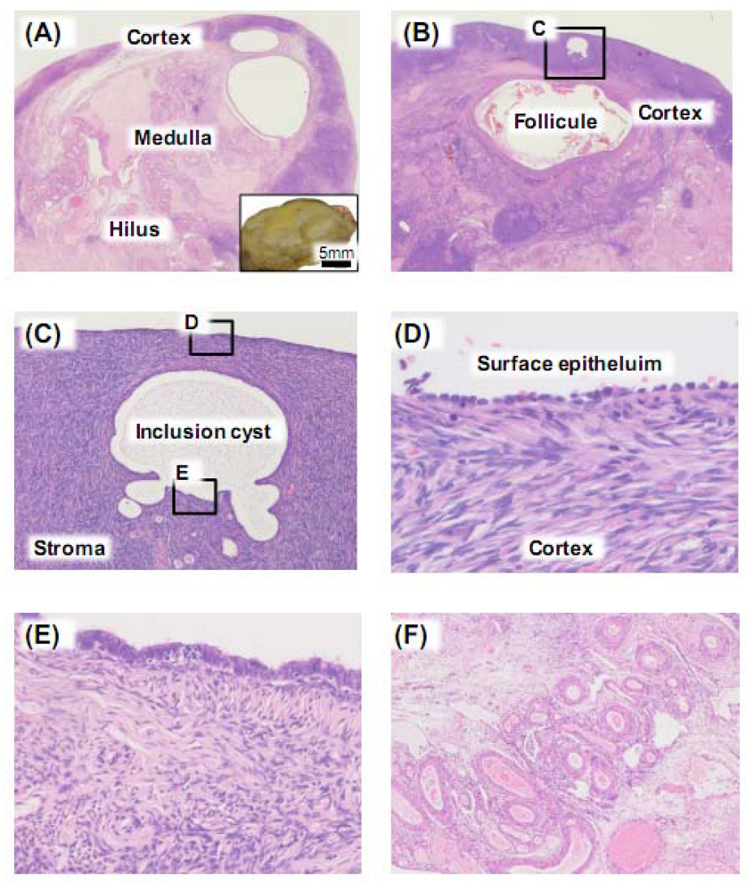 Cancers | Free Full-Text | Ovarian Cancer Stroma: Pathophysiology and the  Roles in Cancer Development