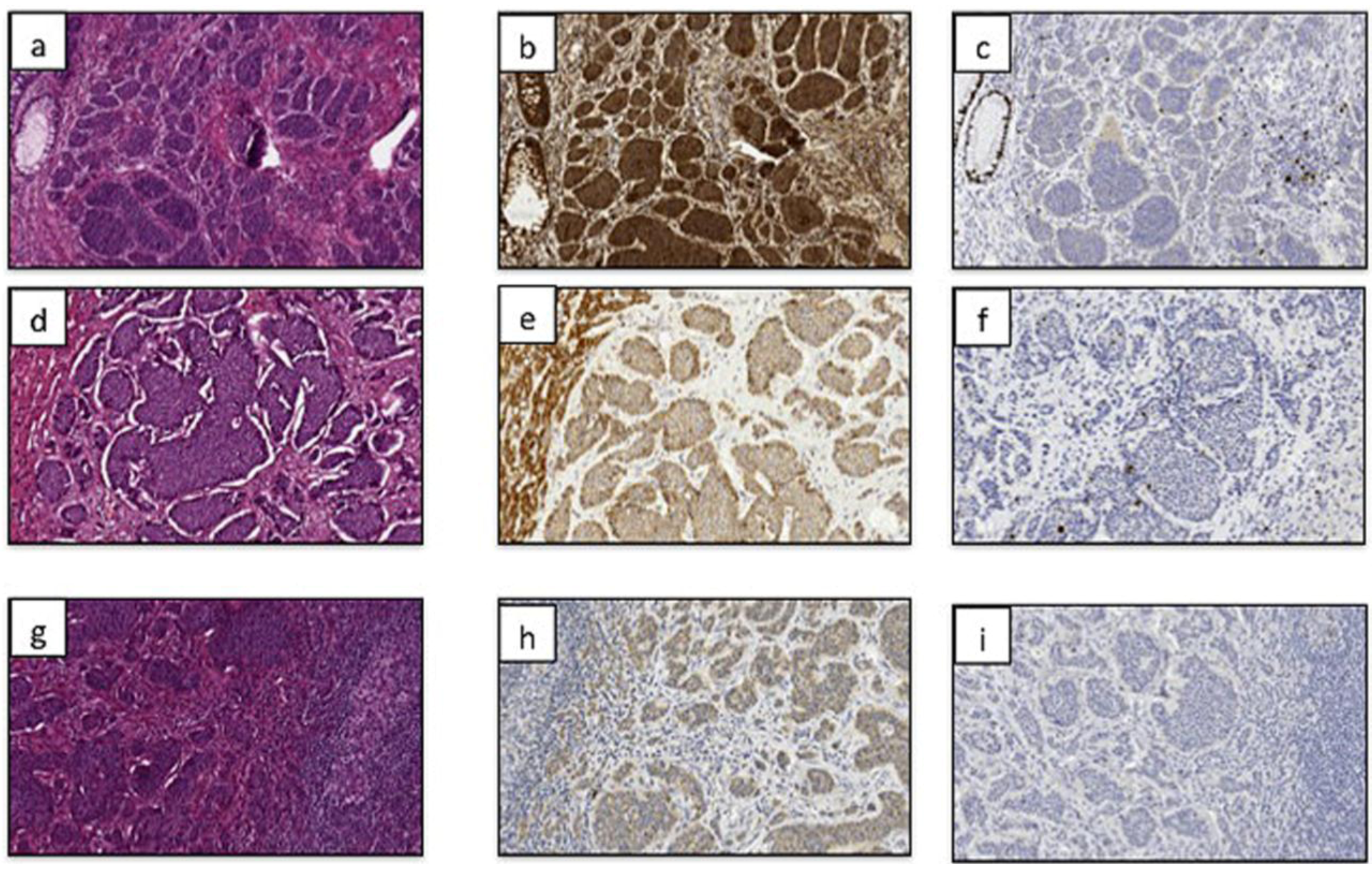 Cancers 04 00808 g001 1024