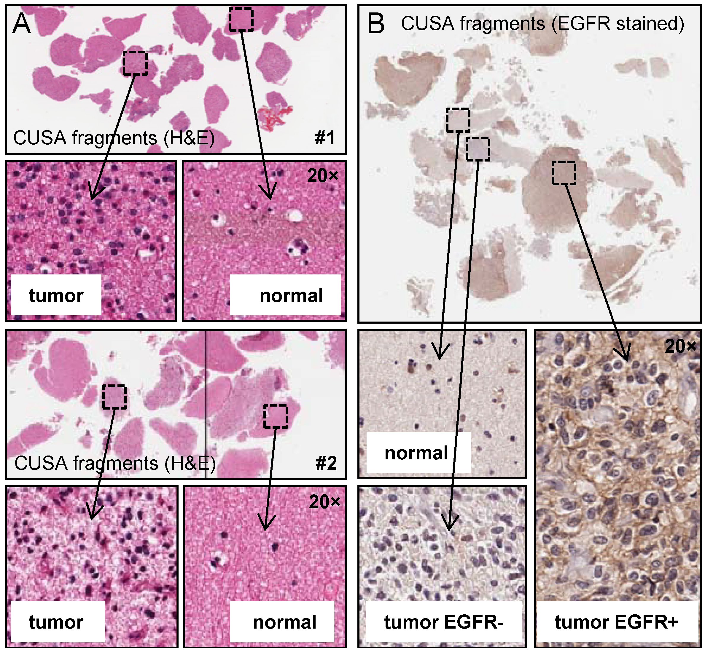 Cancers 05 00357 g002