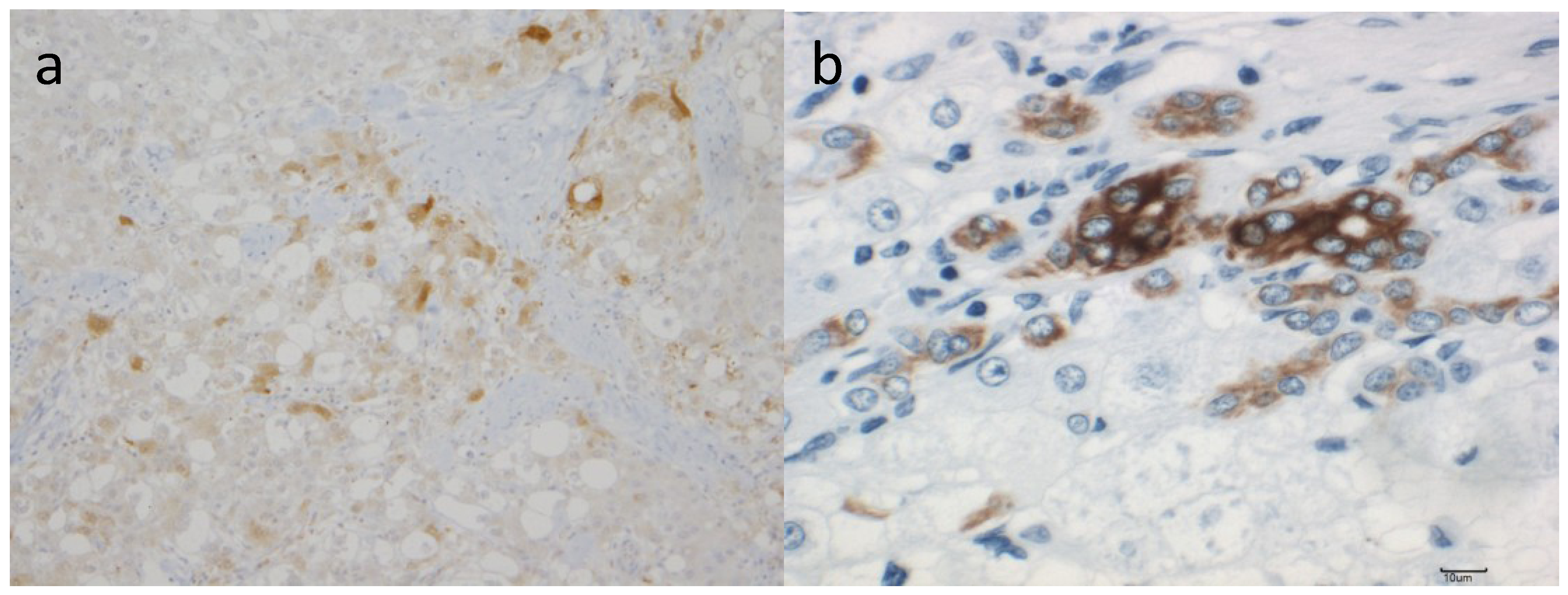 Cancers 06 01220 g003 550