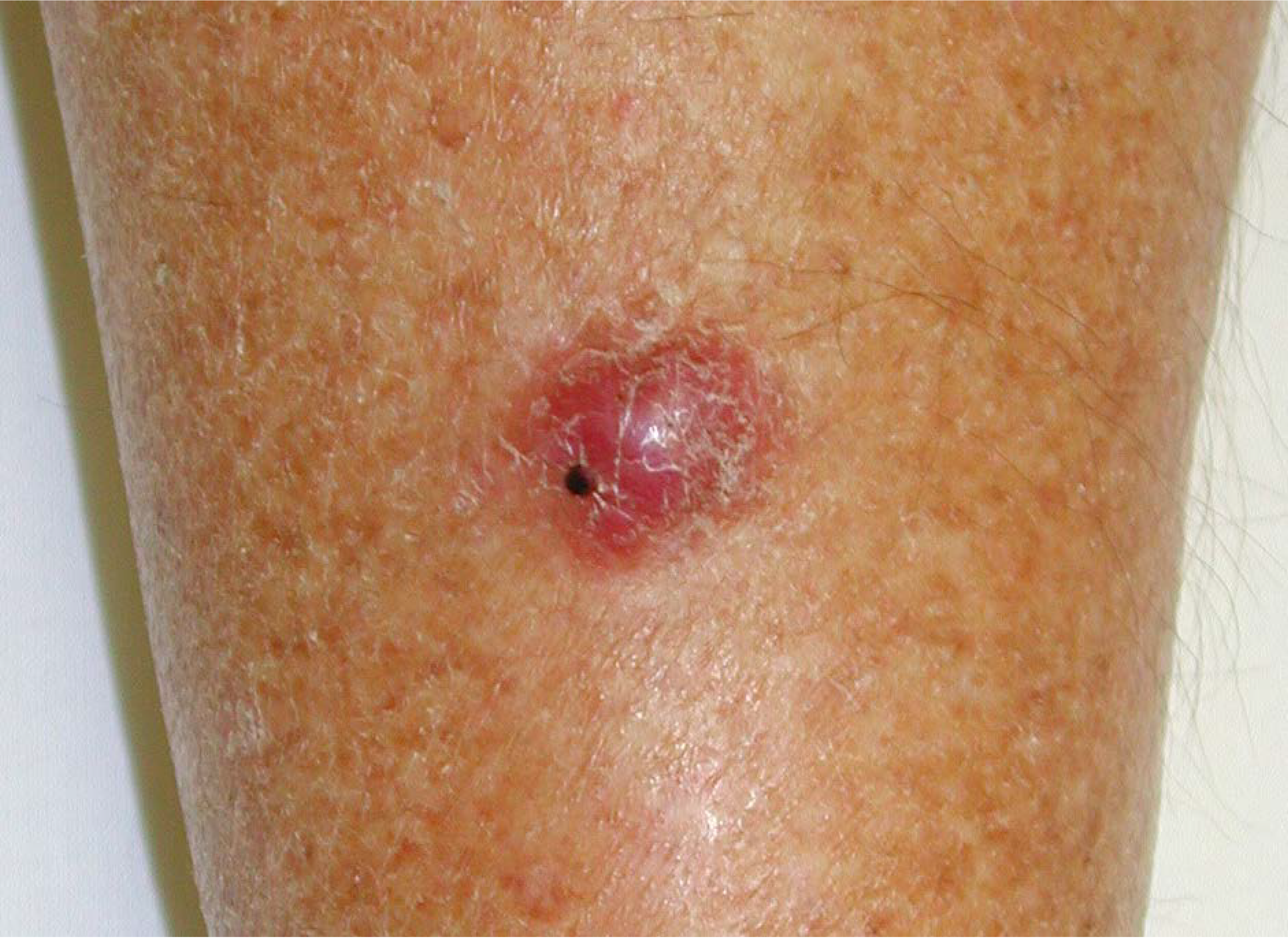 Cancers 06 01267 g002