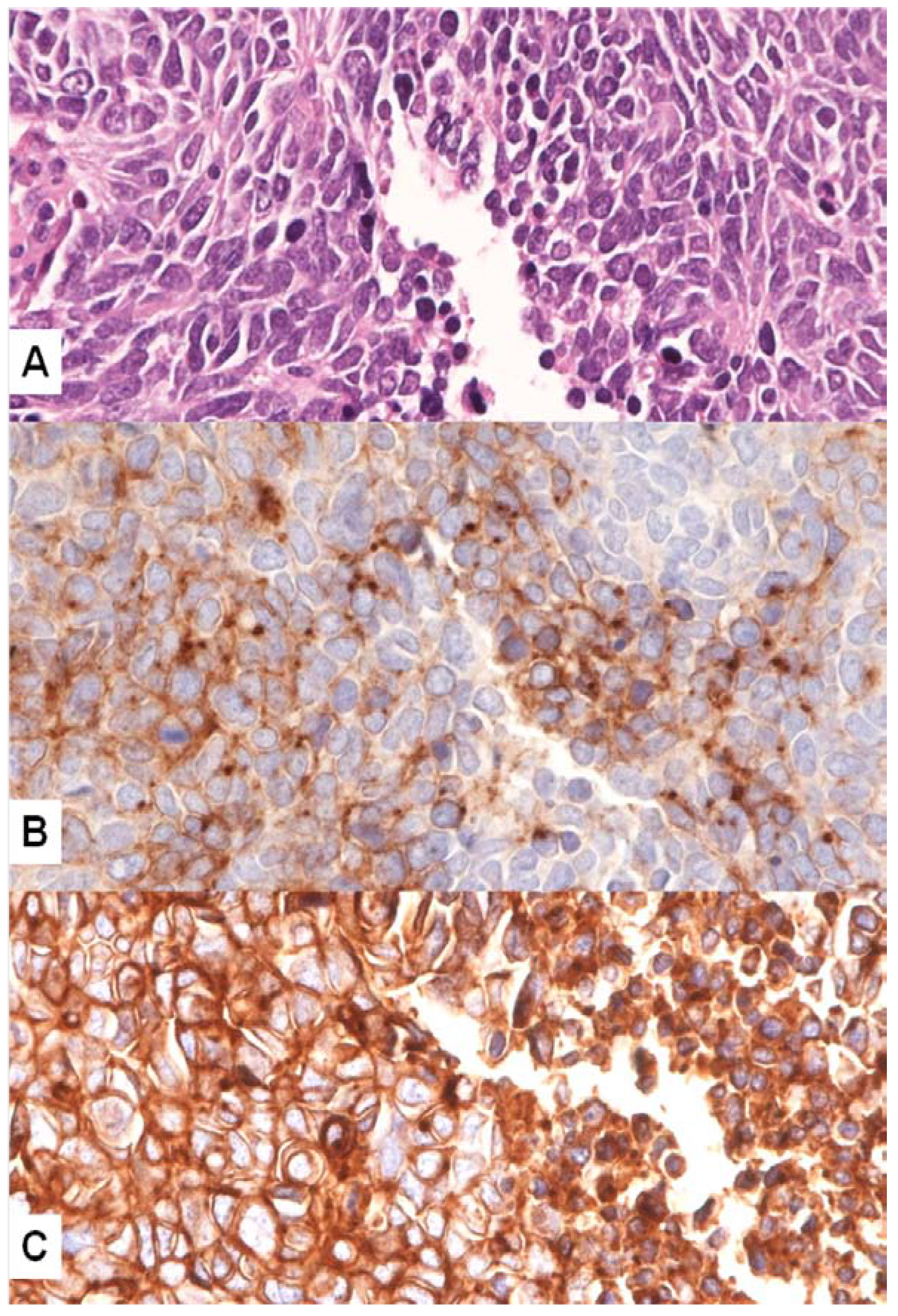 Cancers 06 02100 g002 550