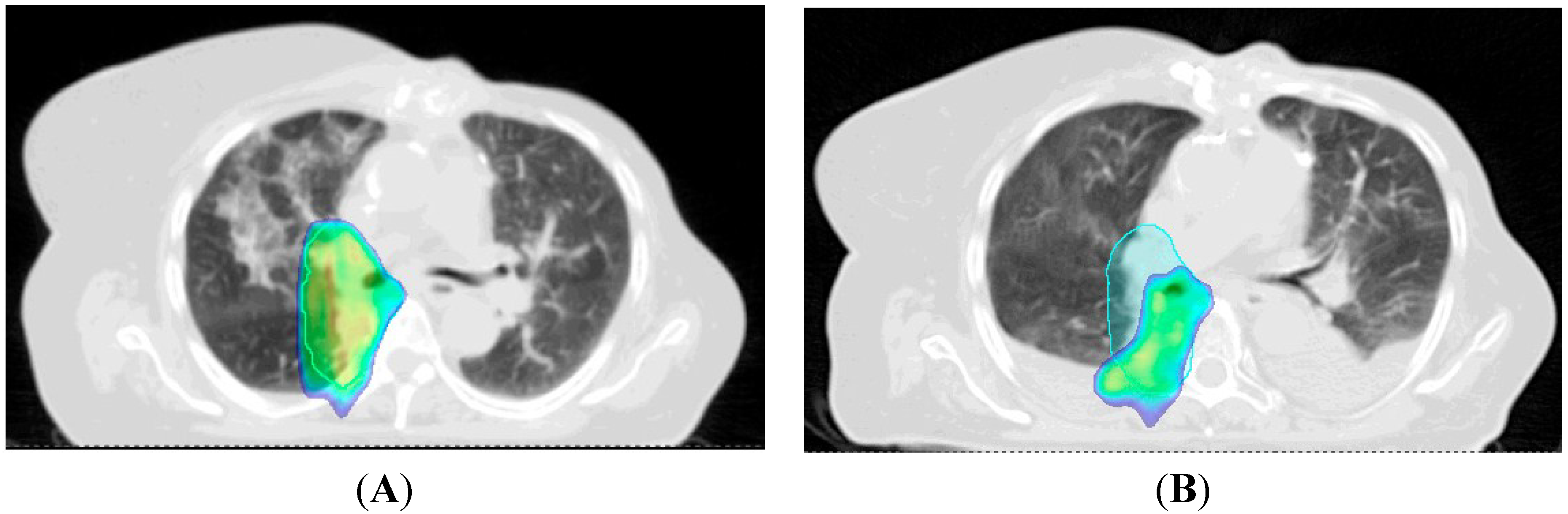 Cancers 07 00831 g003 1024