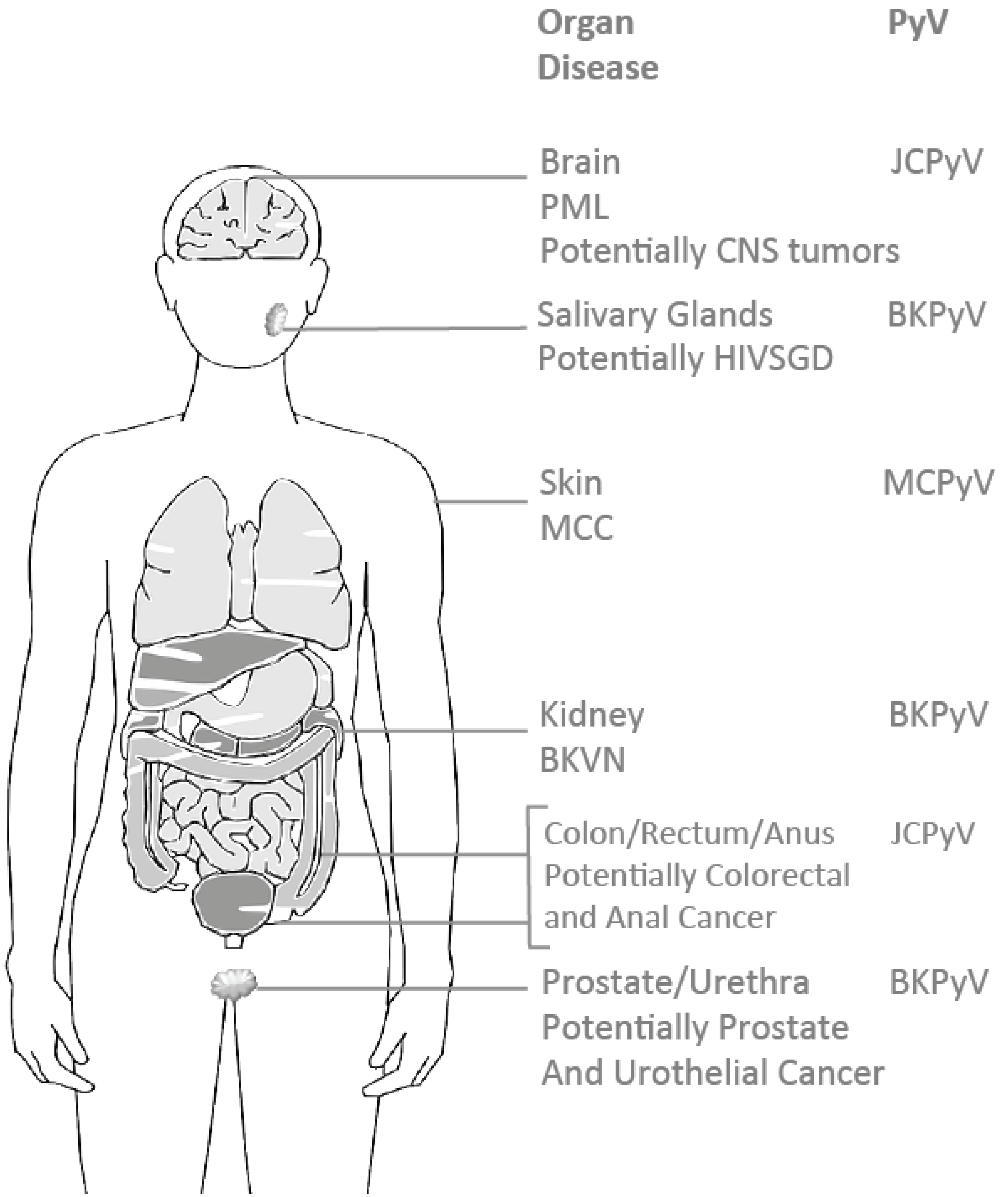 Cancers | Free Full-Text | Human BK Polyomavirus—The Potential for Head and  Neck Malignancy and Disease