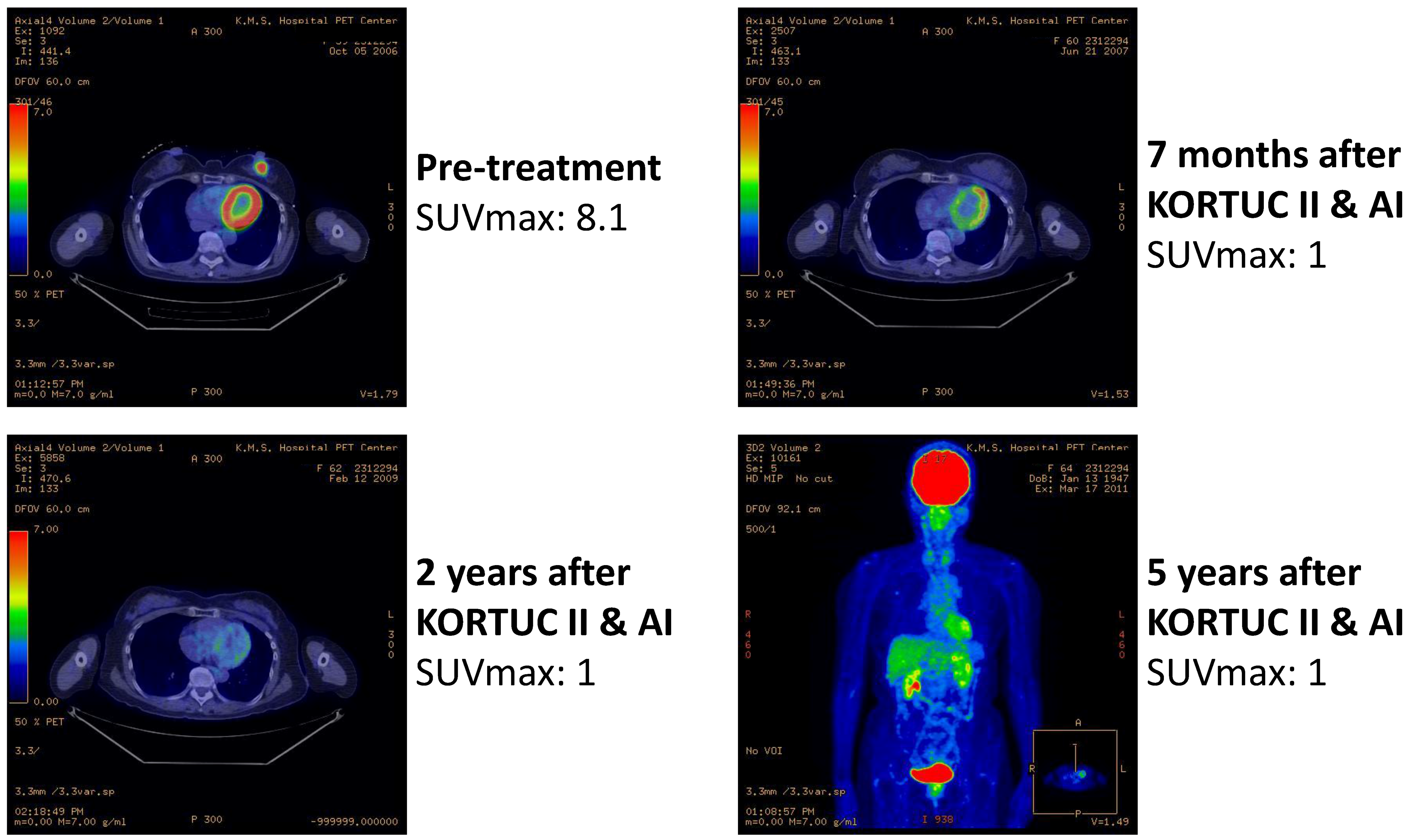 Cancers 07 00891 g004 1024