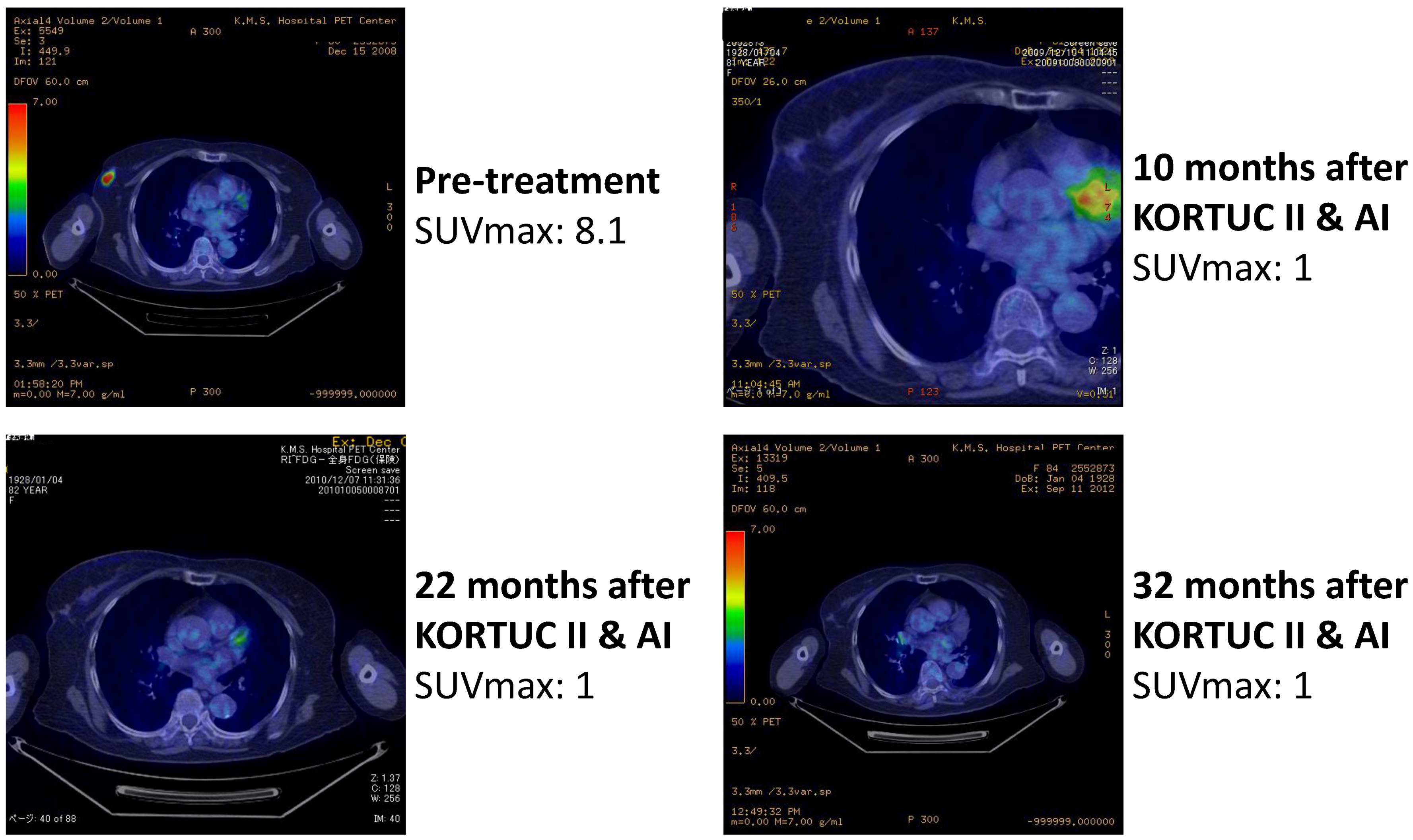 Cancers 07 00891 g005 1024