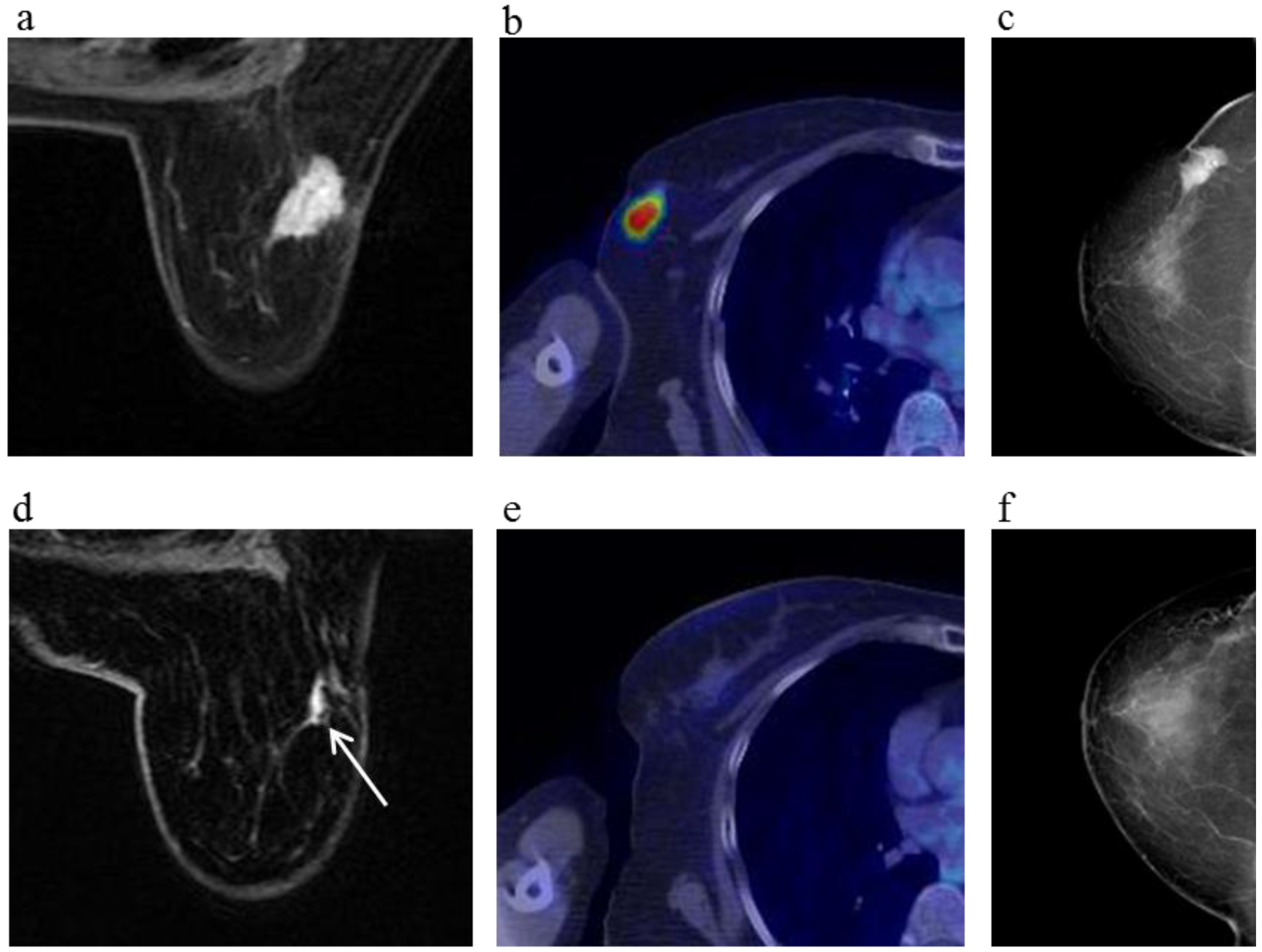 Cancers 08 00001 g003a 1024