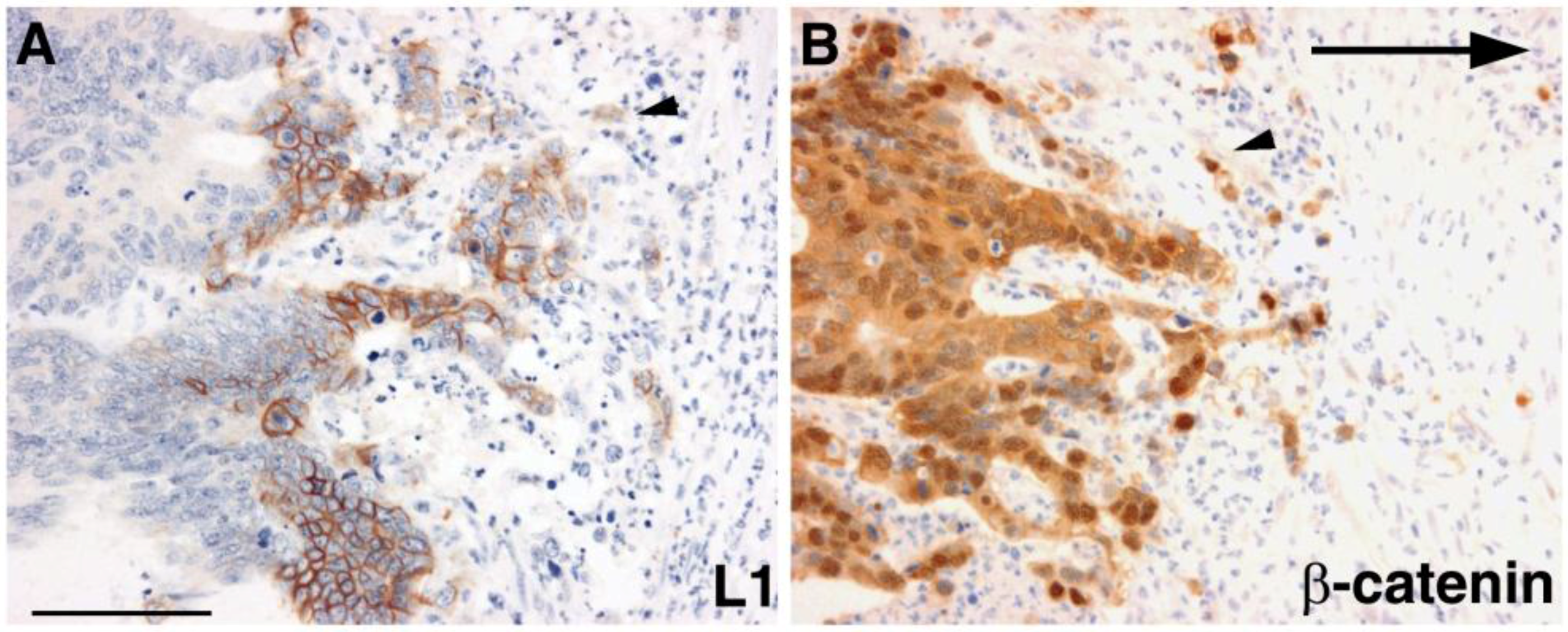 Cancers 08 00048 g001 1024