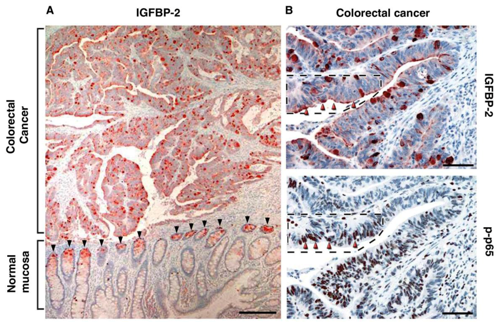 Cancers 08 00048 g004 1024