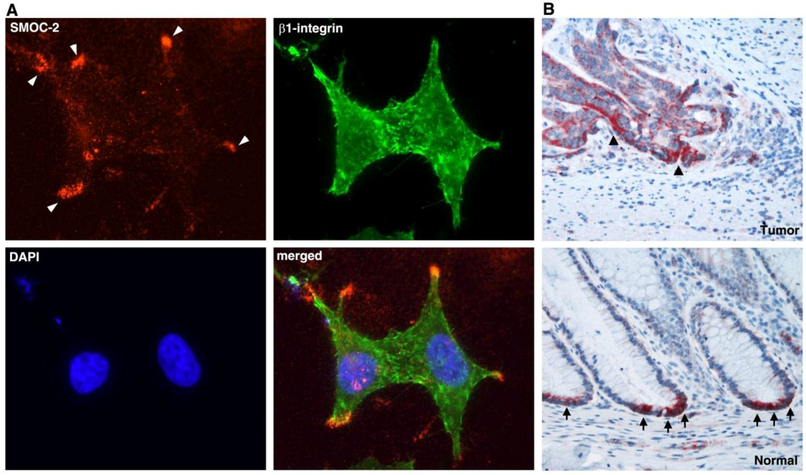 Cancers 08 00048 g005 1024