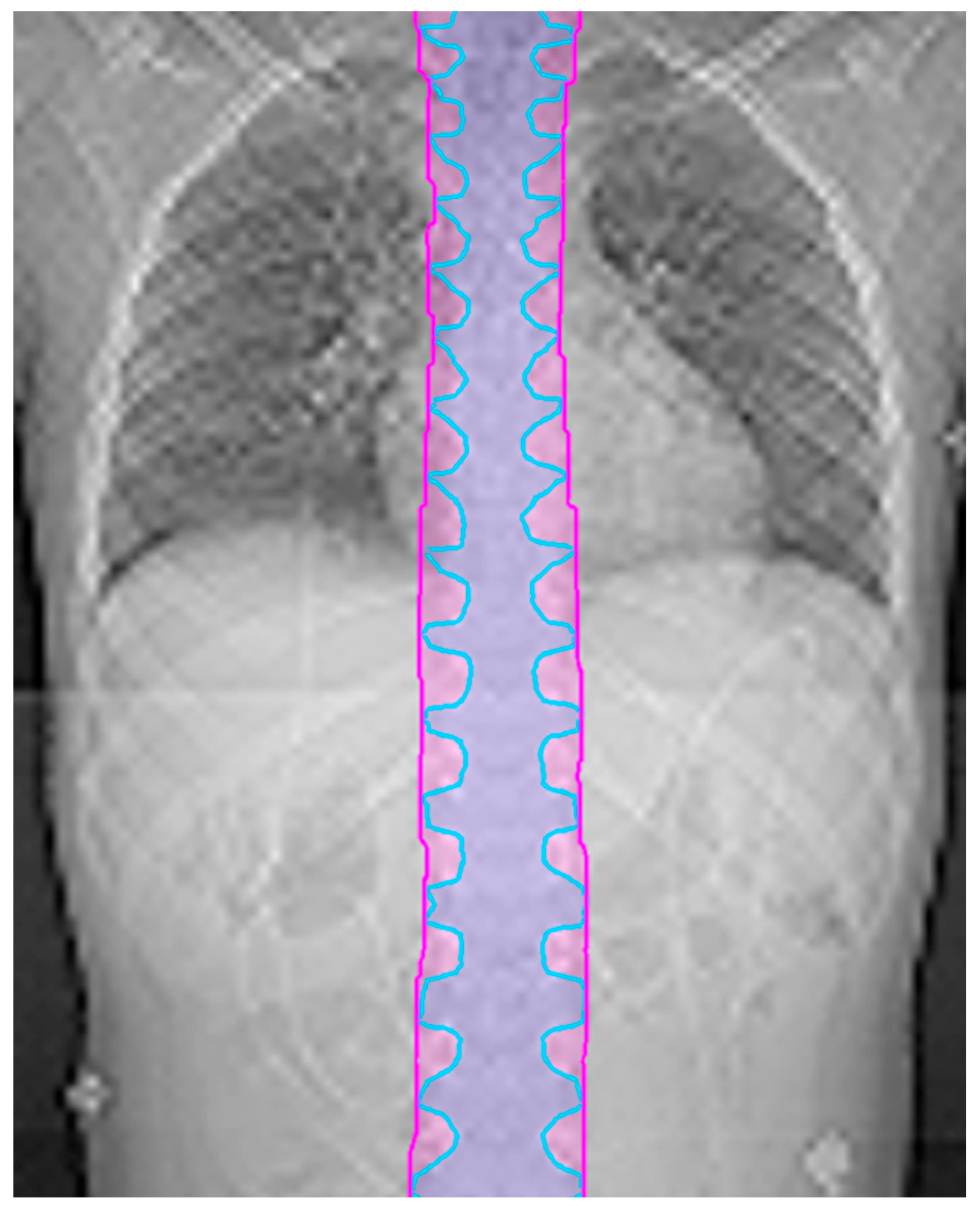 Cancers 10 00007 g001 550