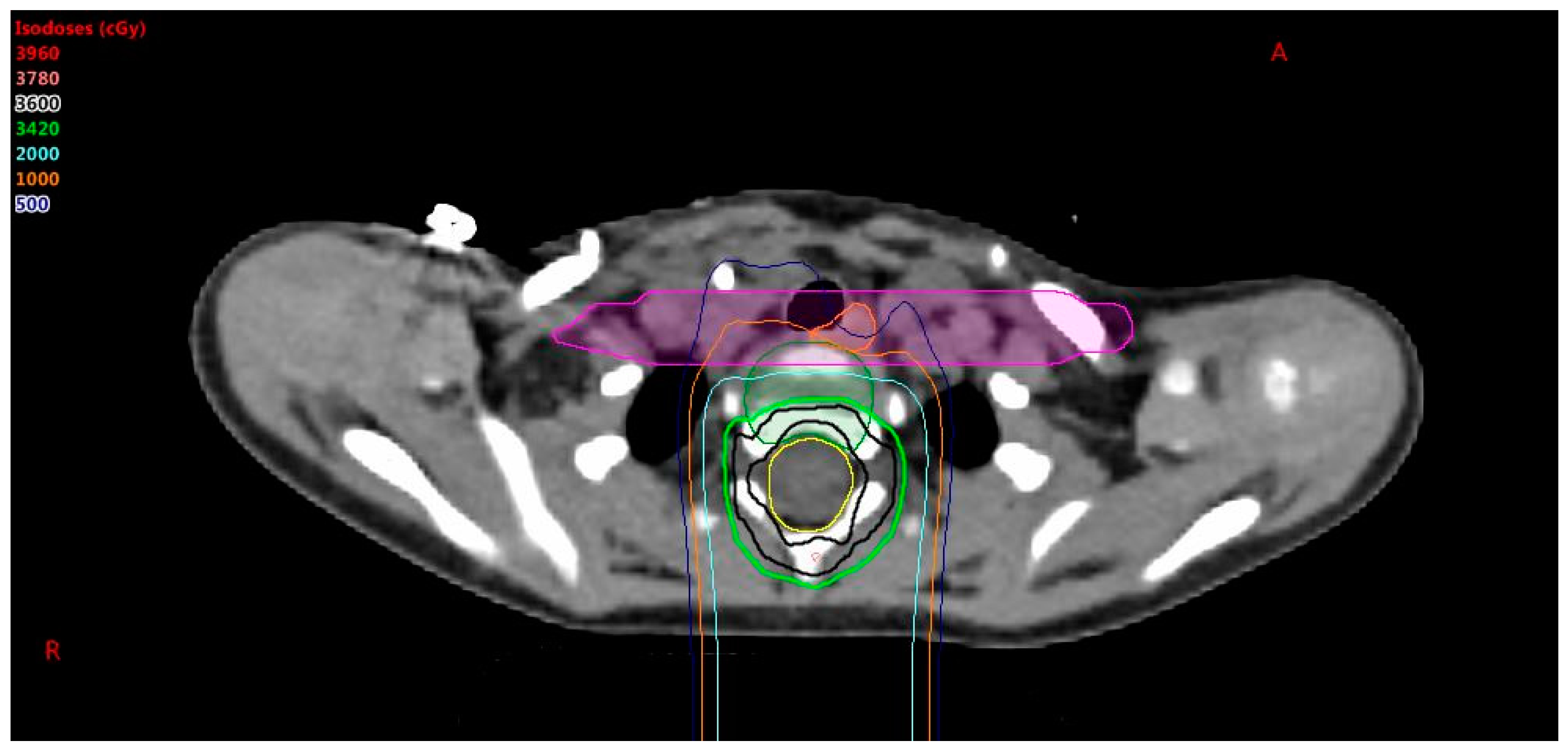 Cancers 10 00007 g002 550