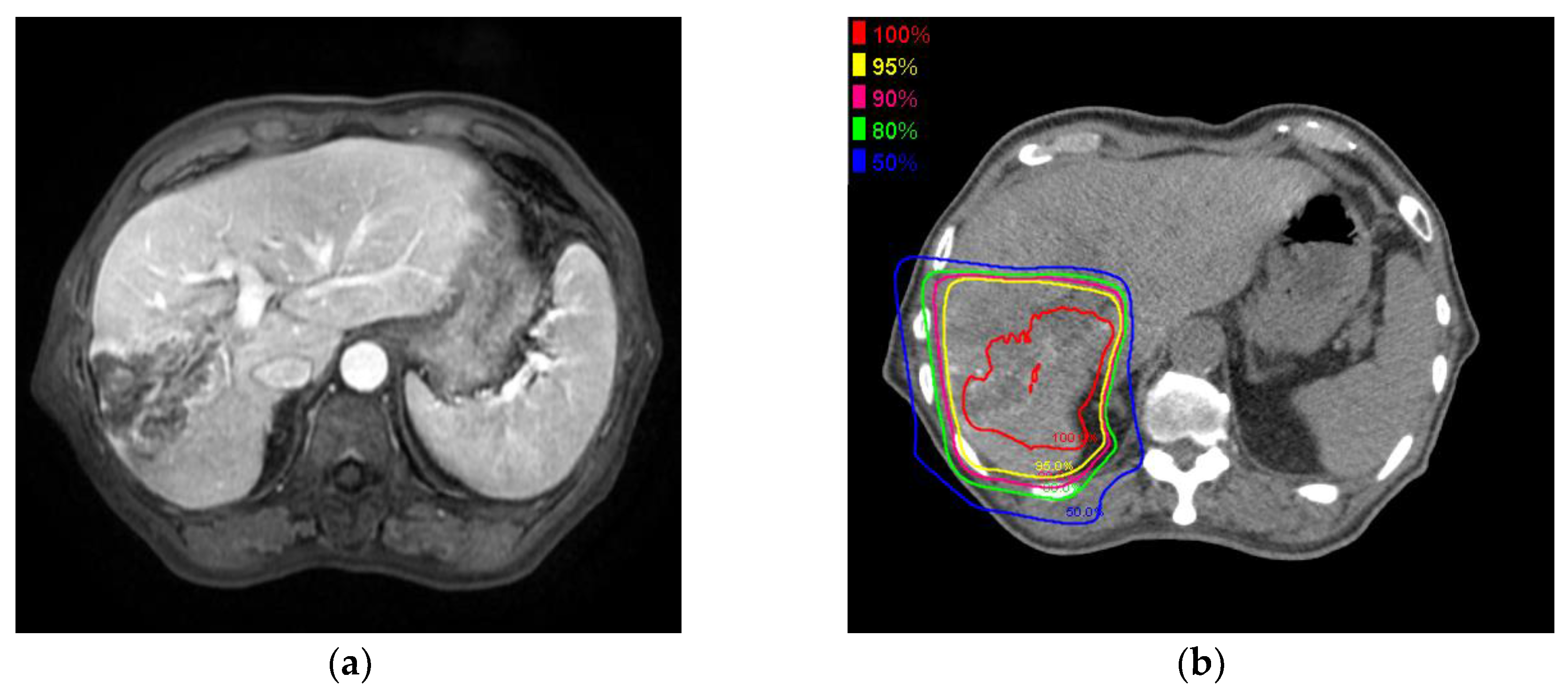 Cancers 10 00058 g002a