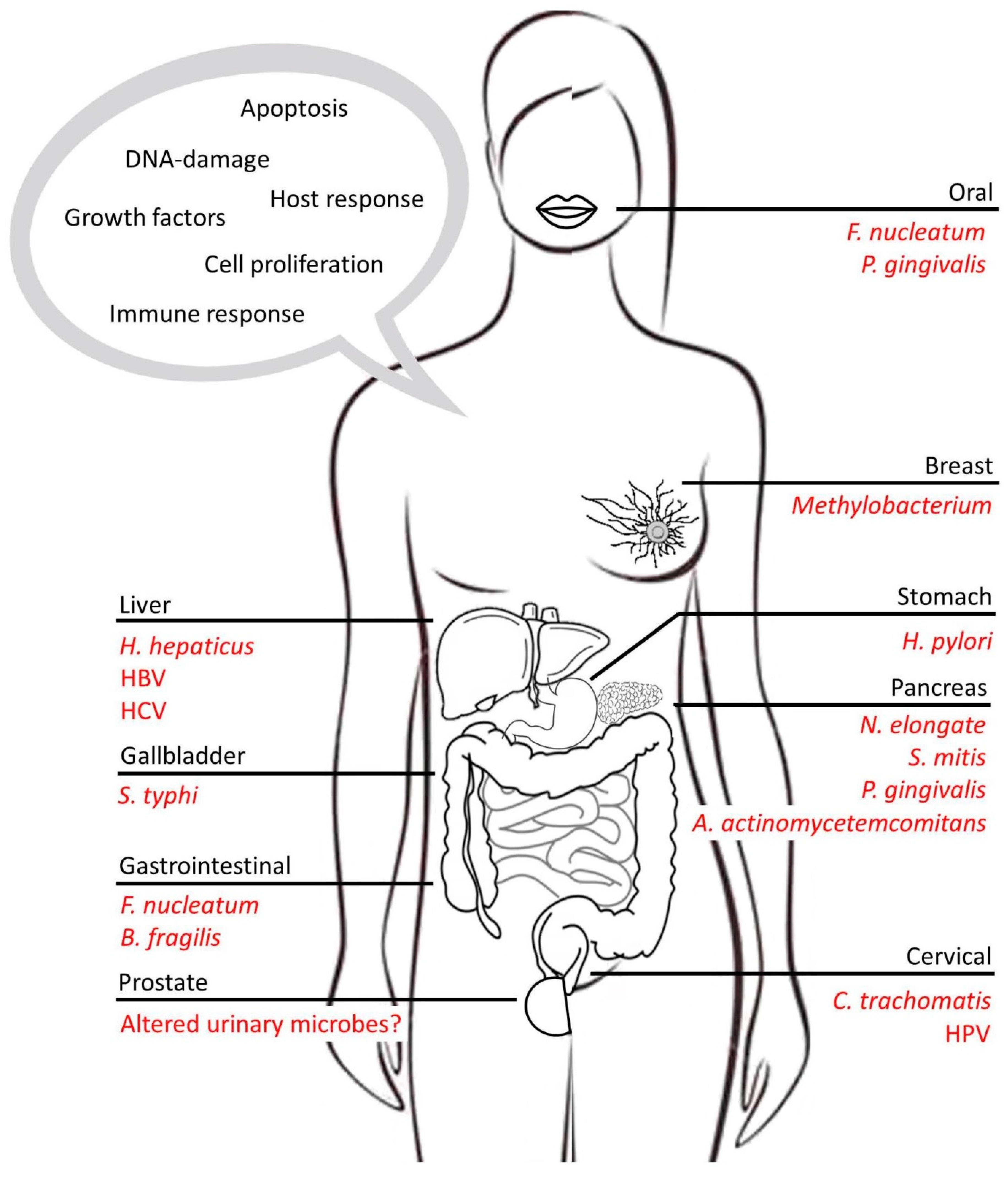 Cancers Free Full-Text | The Complex Interplay between Chronic Inflammation, the Microbiome, and Understanding Disease Progression and What We Can Do to Prevent It