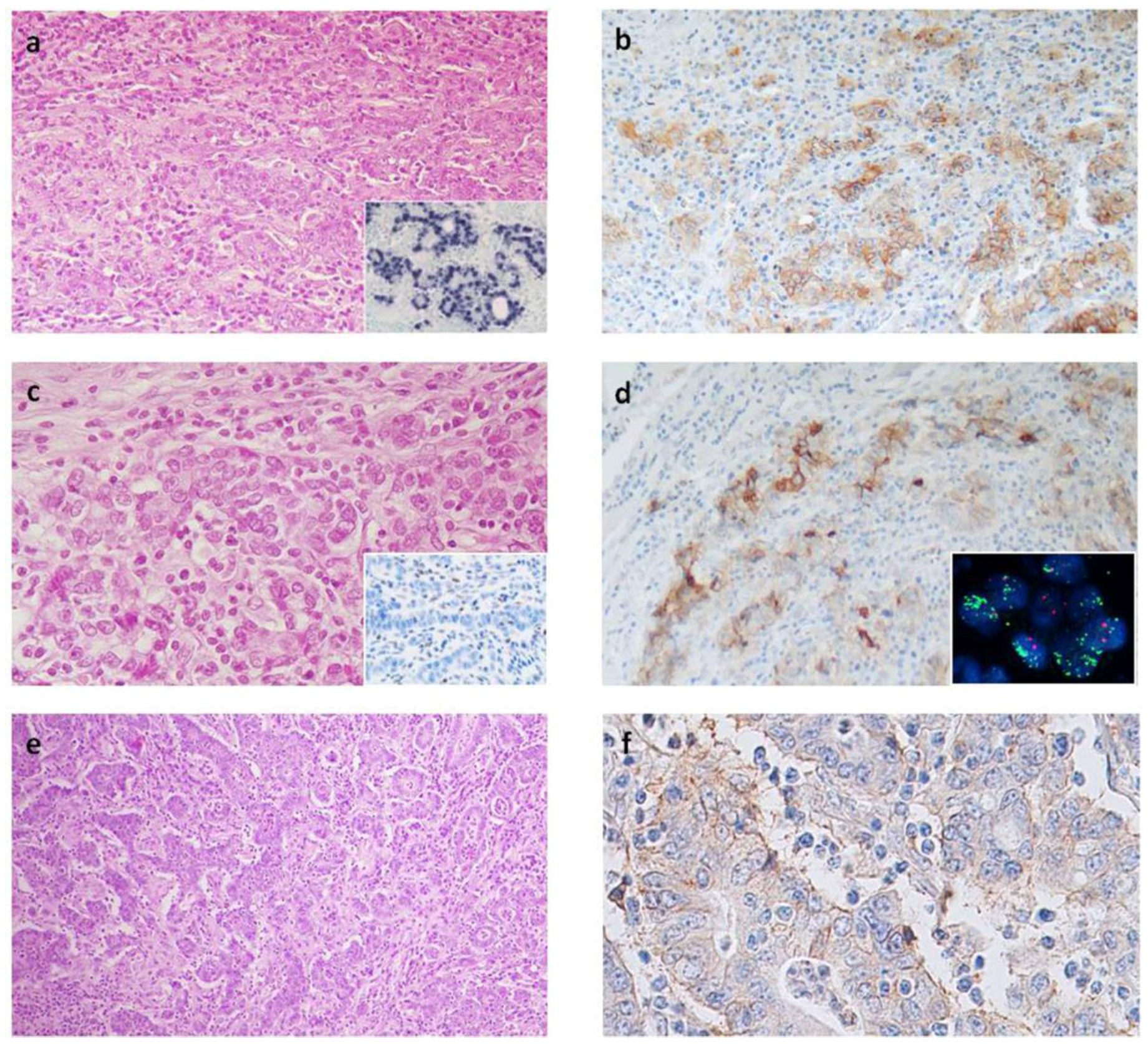 Cancers 10 00102 g001 Cancers 10 00102 g001