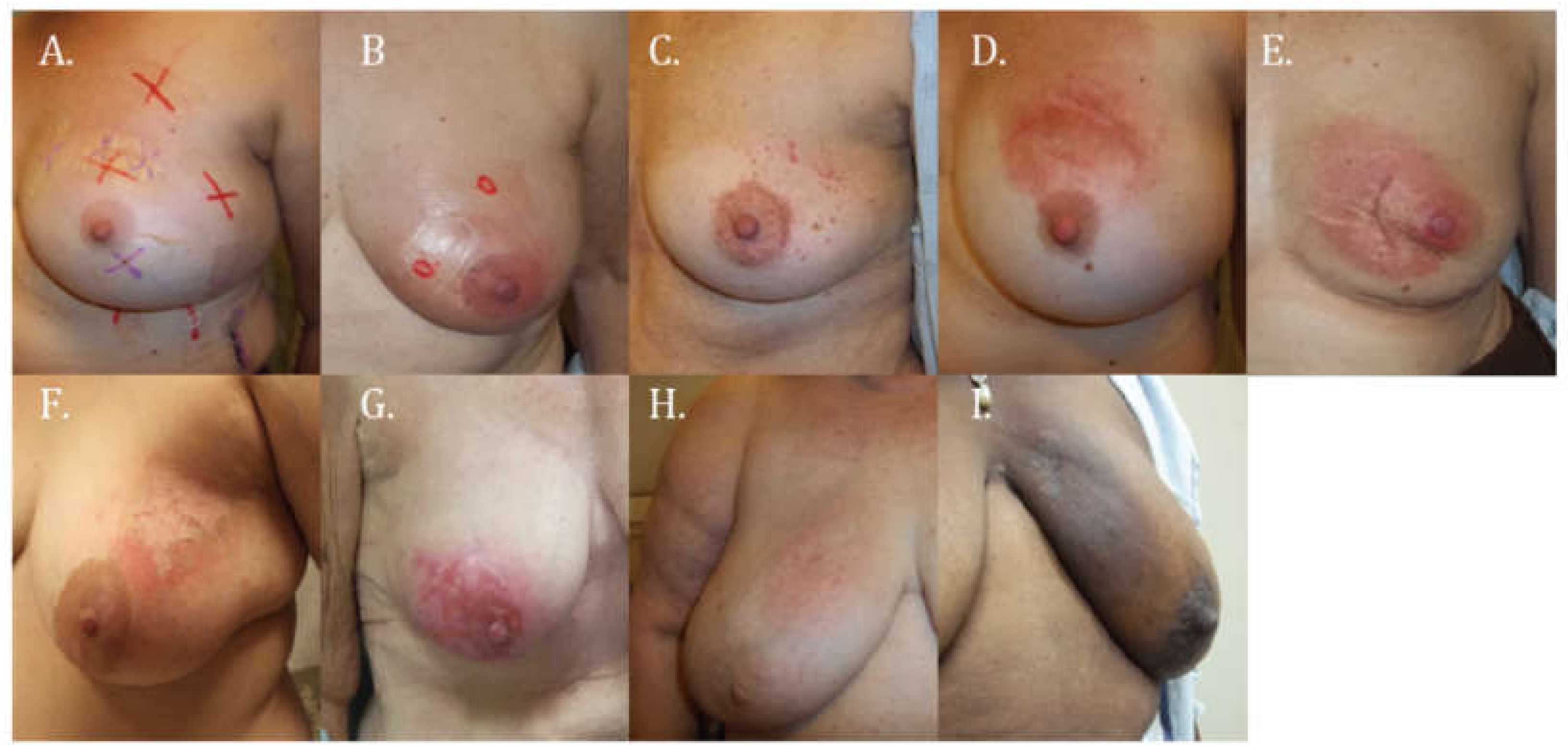 Cancers 10 00111 g001