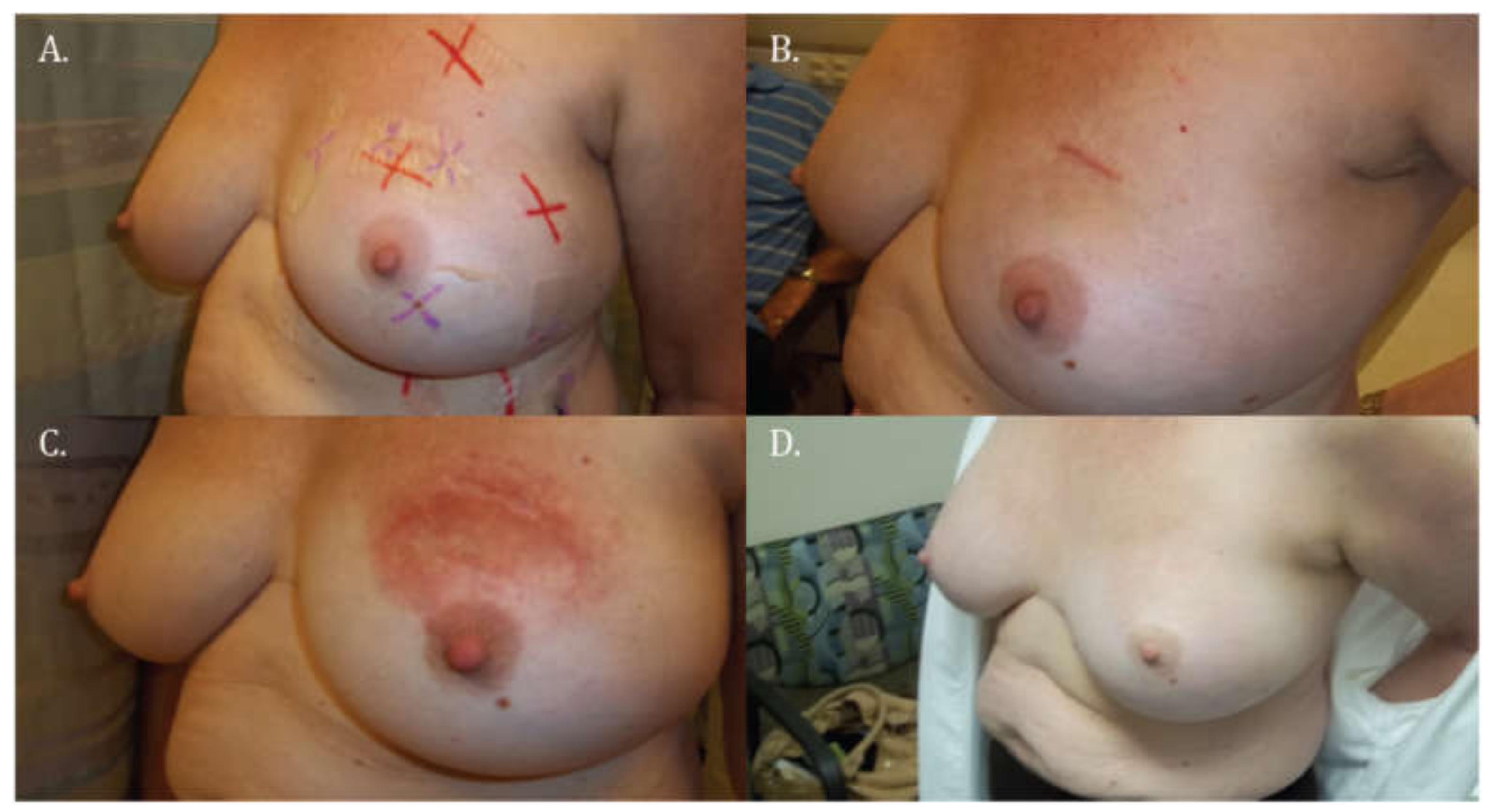 Cancers 10 00111 g003