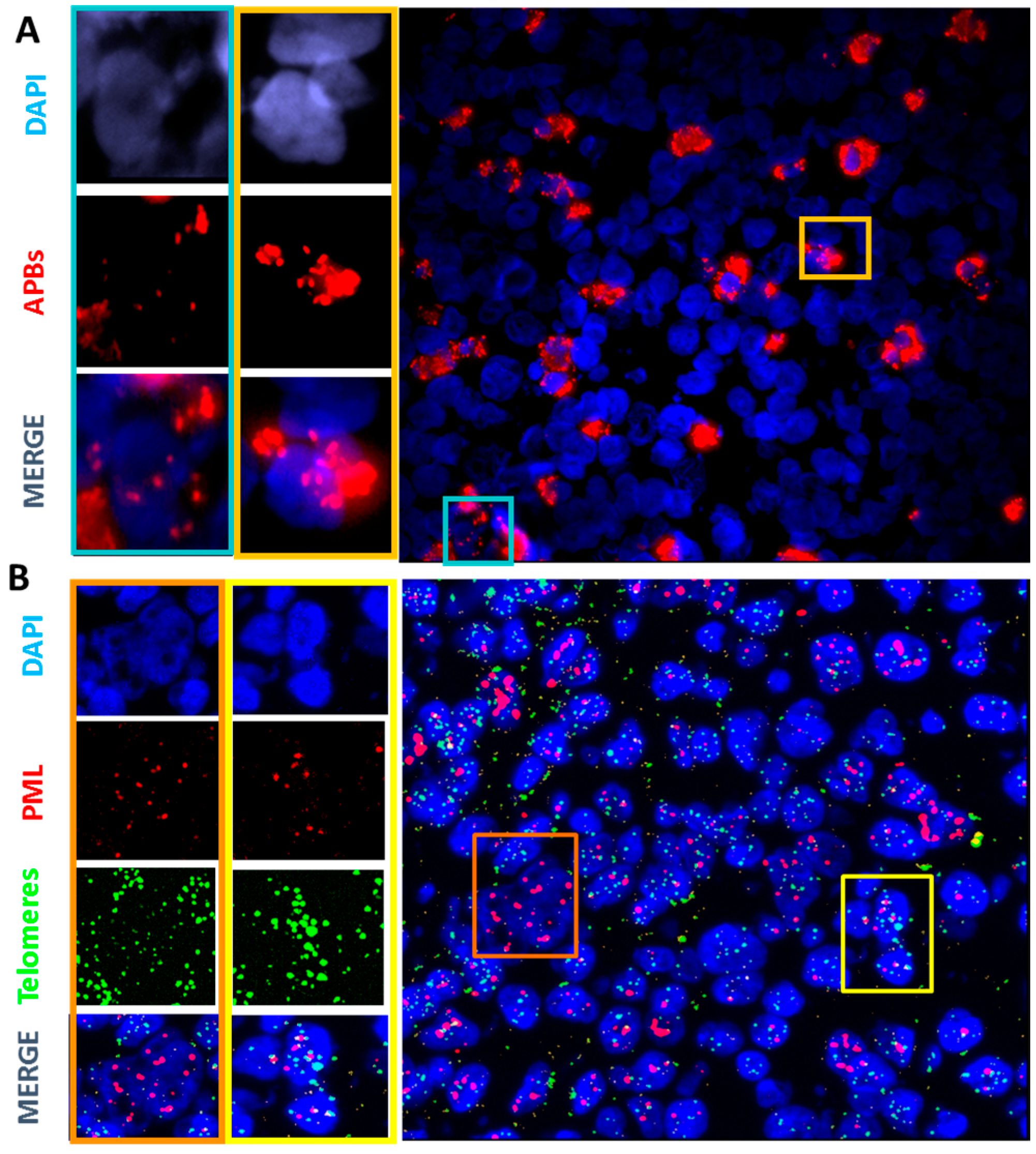 Cancers 10 00169 g006