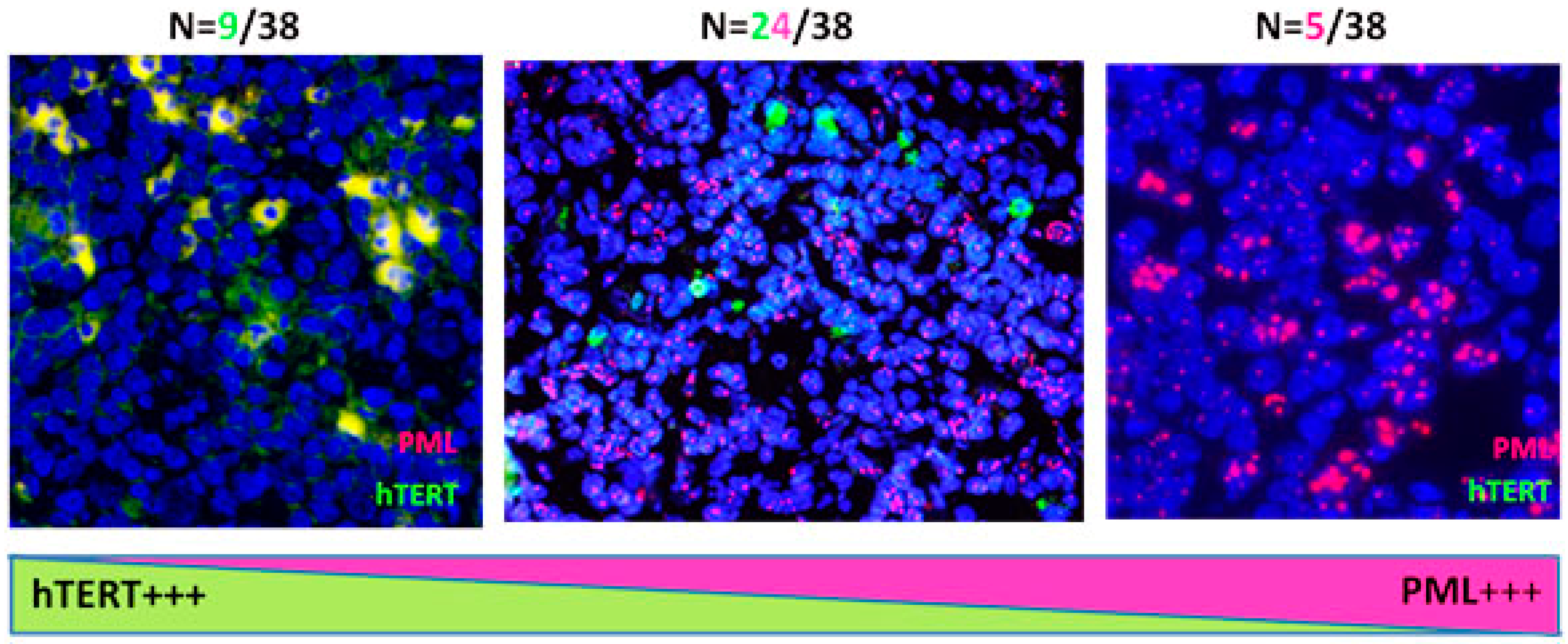 Cancers 10 00169 g007