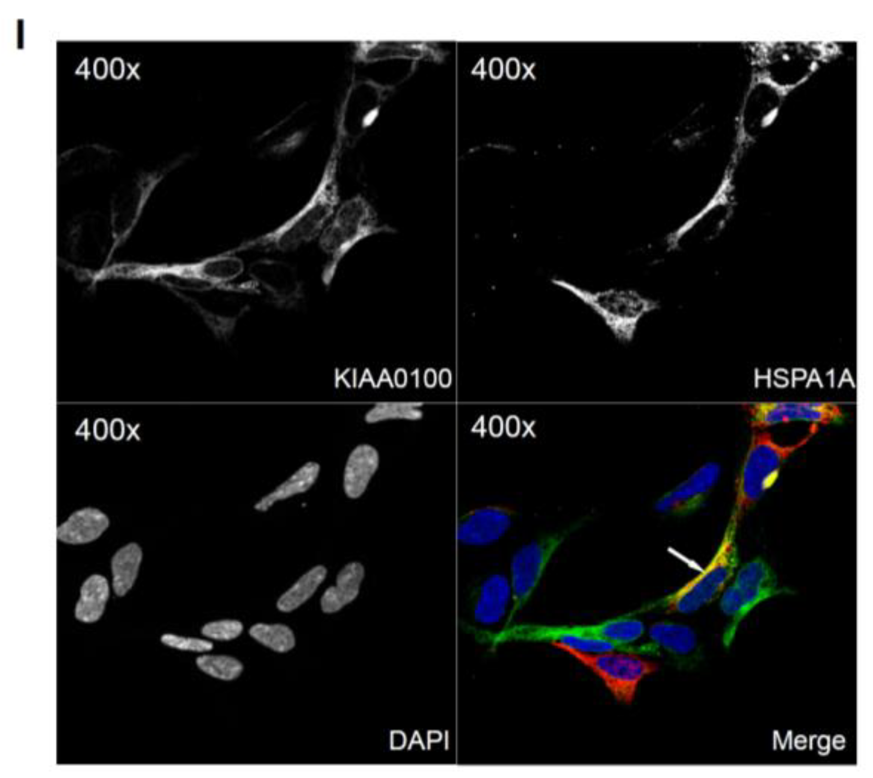 Cancers 10 00180 g006b Cancers 10 00180 g006b