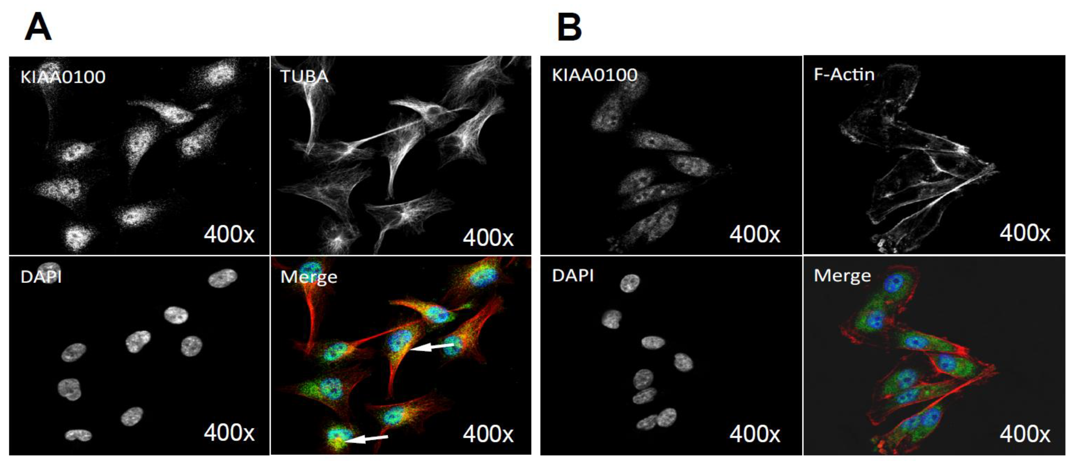 Cancers 10 00180 g008a Cancers 10 00180 g008a