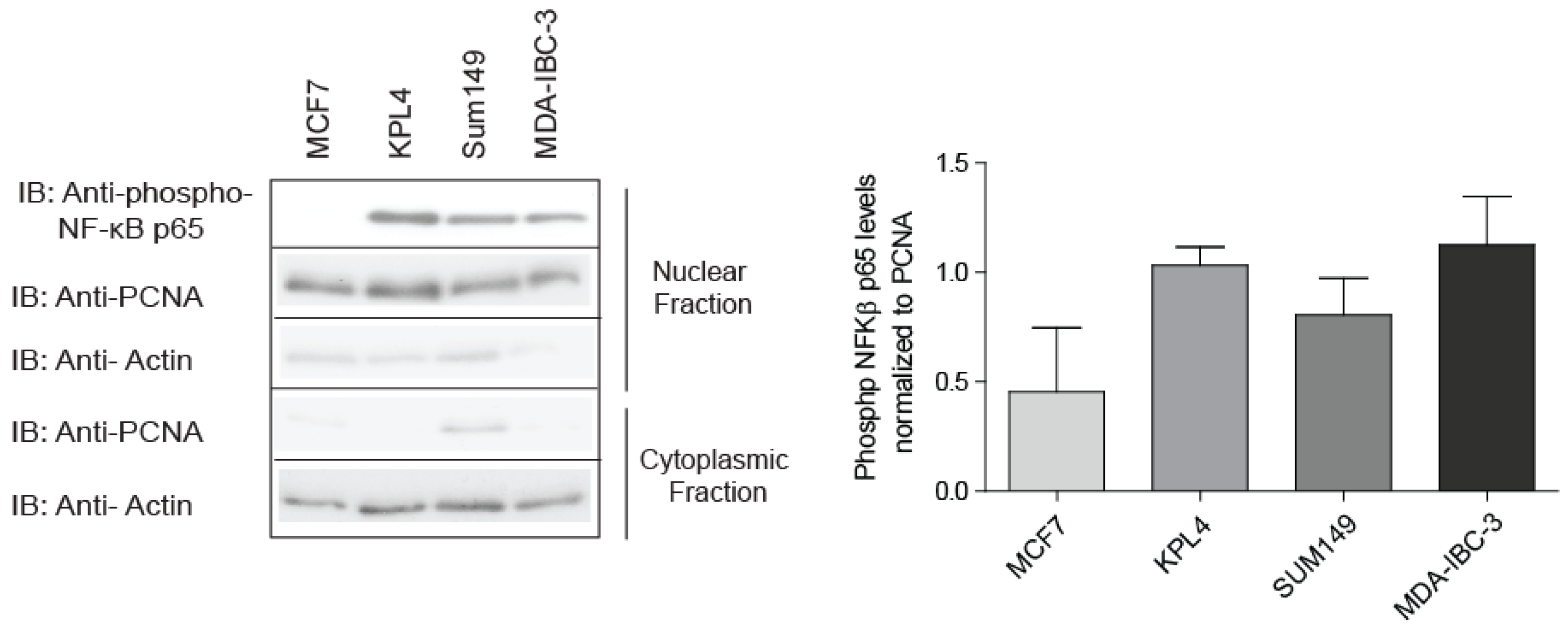 Cancers Free Full Text Ripk2 New Elements In Modulating Inflammatory Breast Cancer Pathogenesis