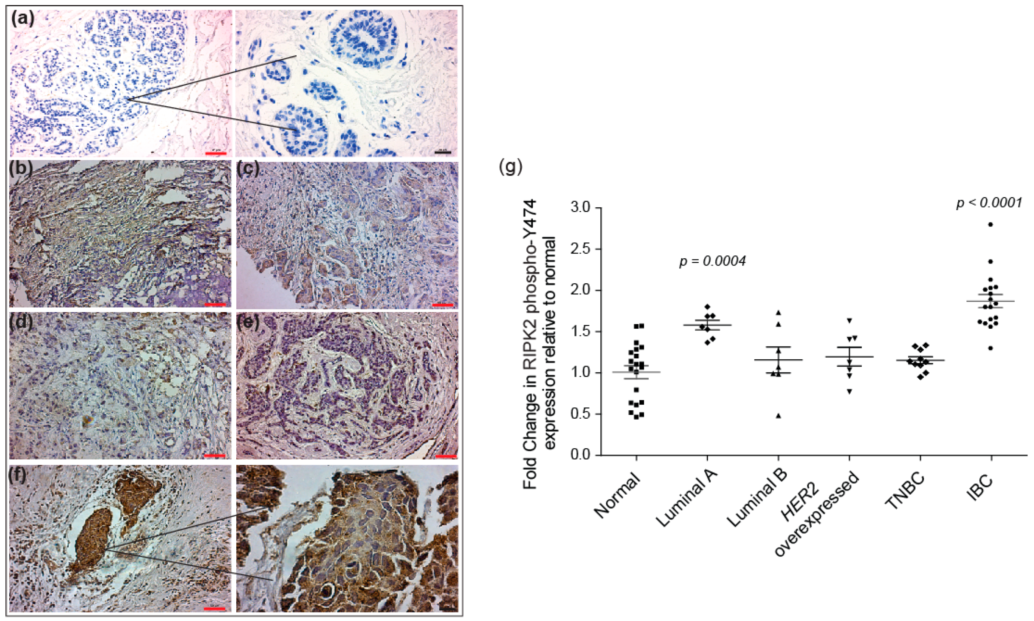 Cancers 10 00184 g003 Cancers 10 00184 g003