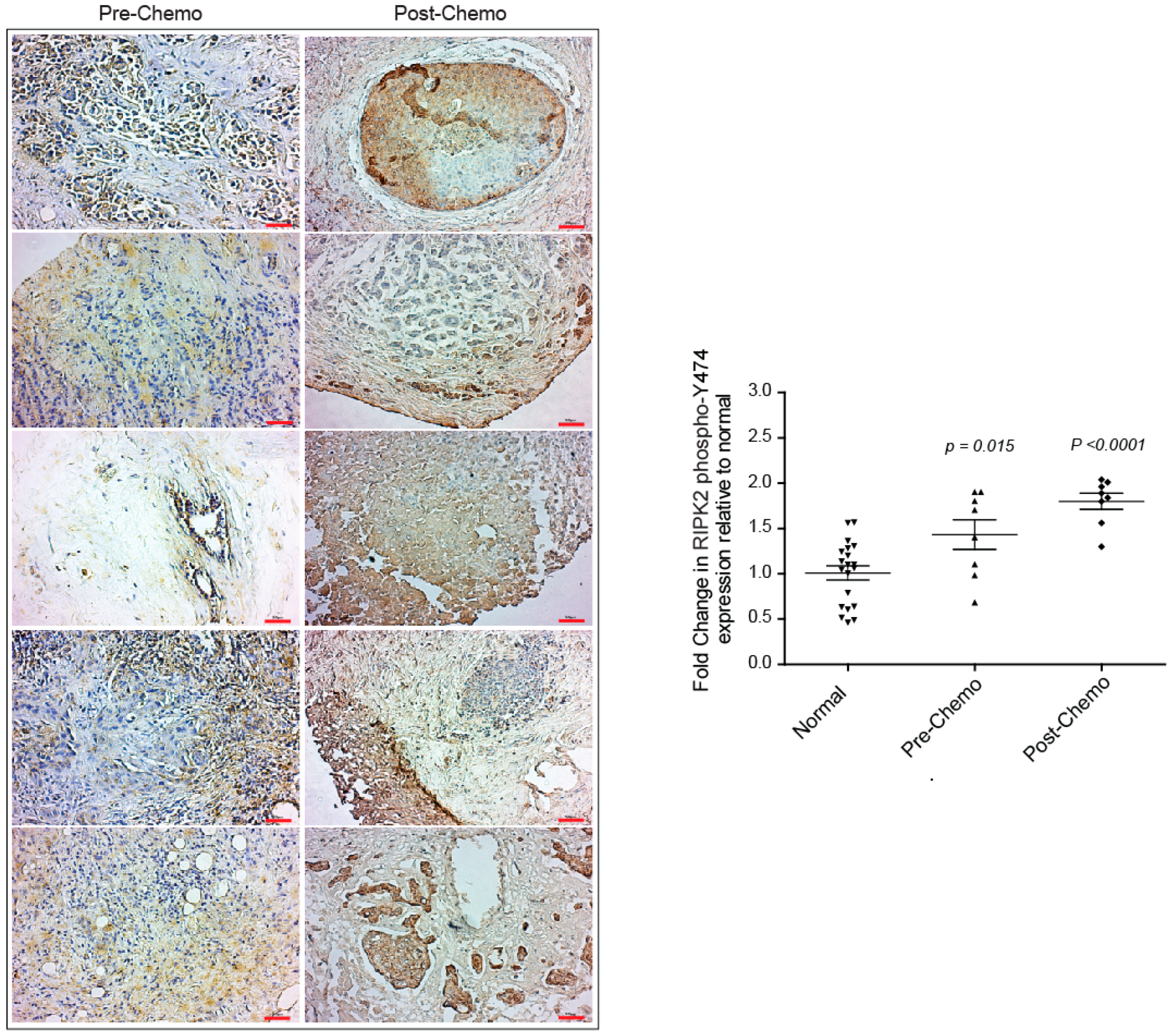 Cancers 10 00184 g004 Cancers 10 00184 g004