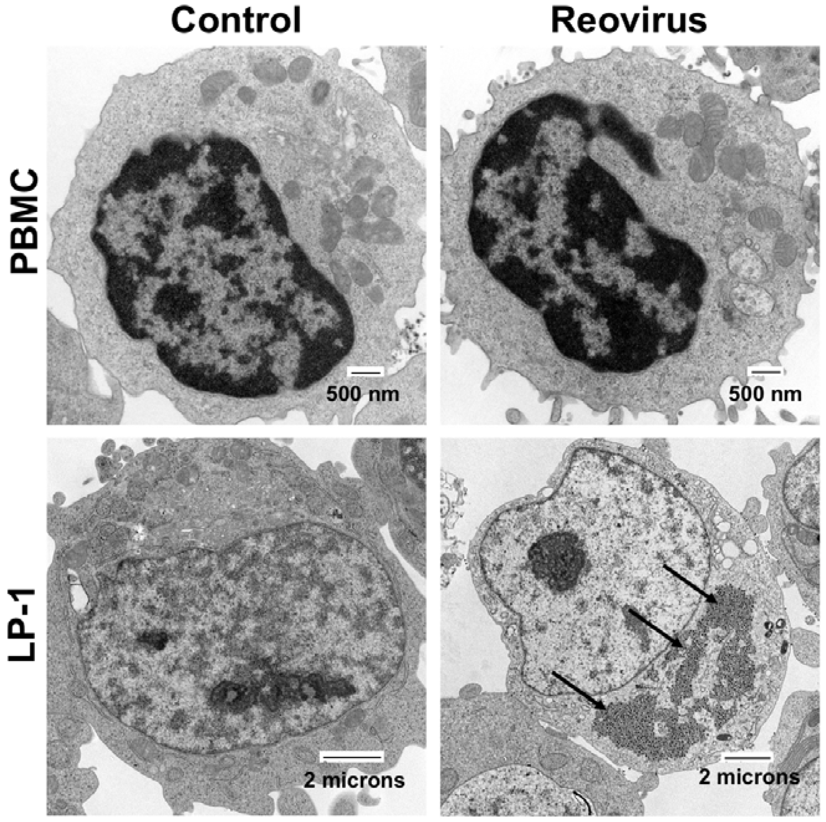 Cancers 10 00198 g001 Cancers 10 00198 g001